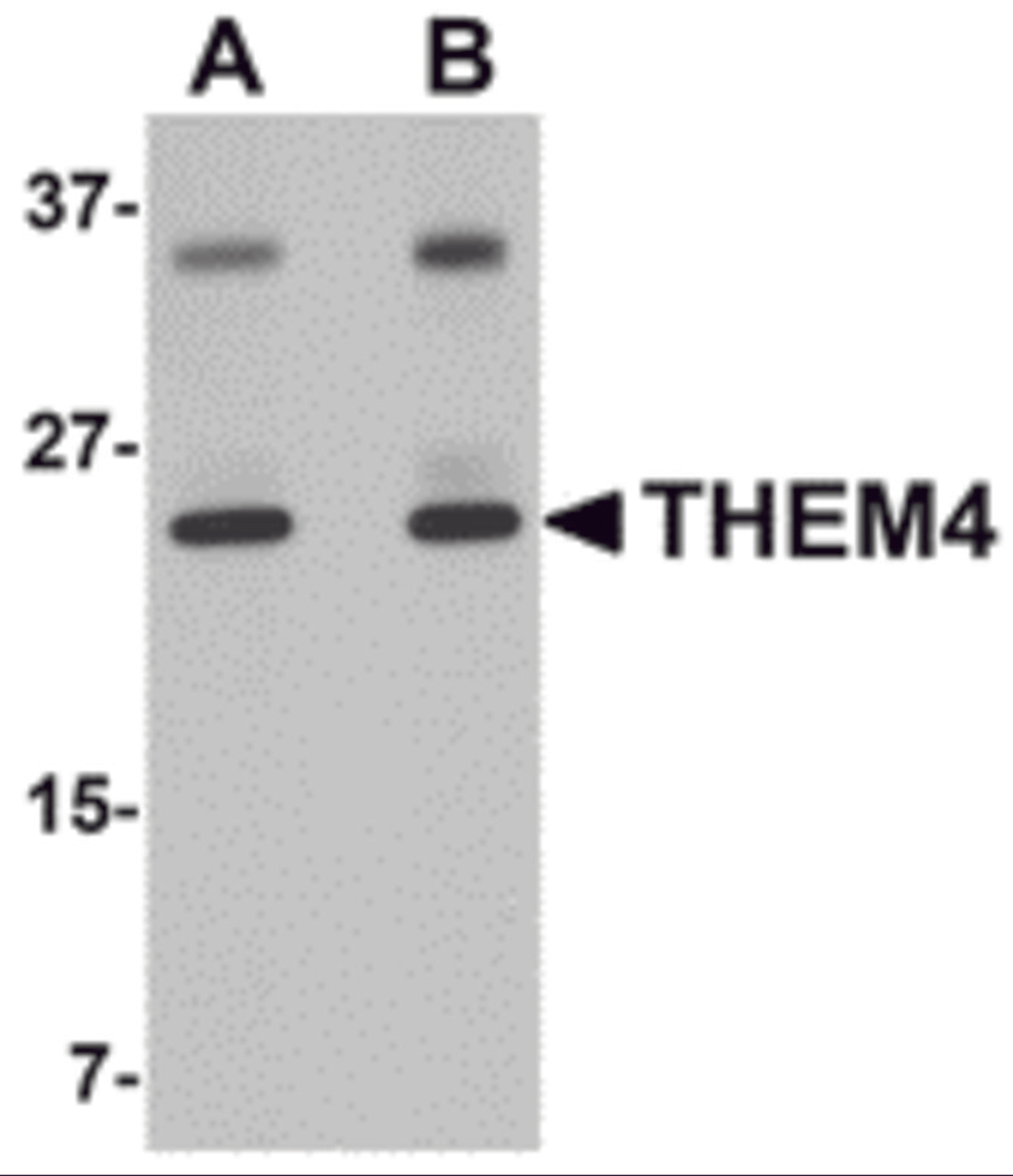 Western blot analysis of THEM4 in human liver tissue lysate with THEM4 antibody at (A) 1 and (B) 2 μg/mL.