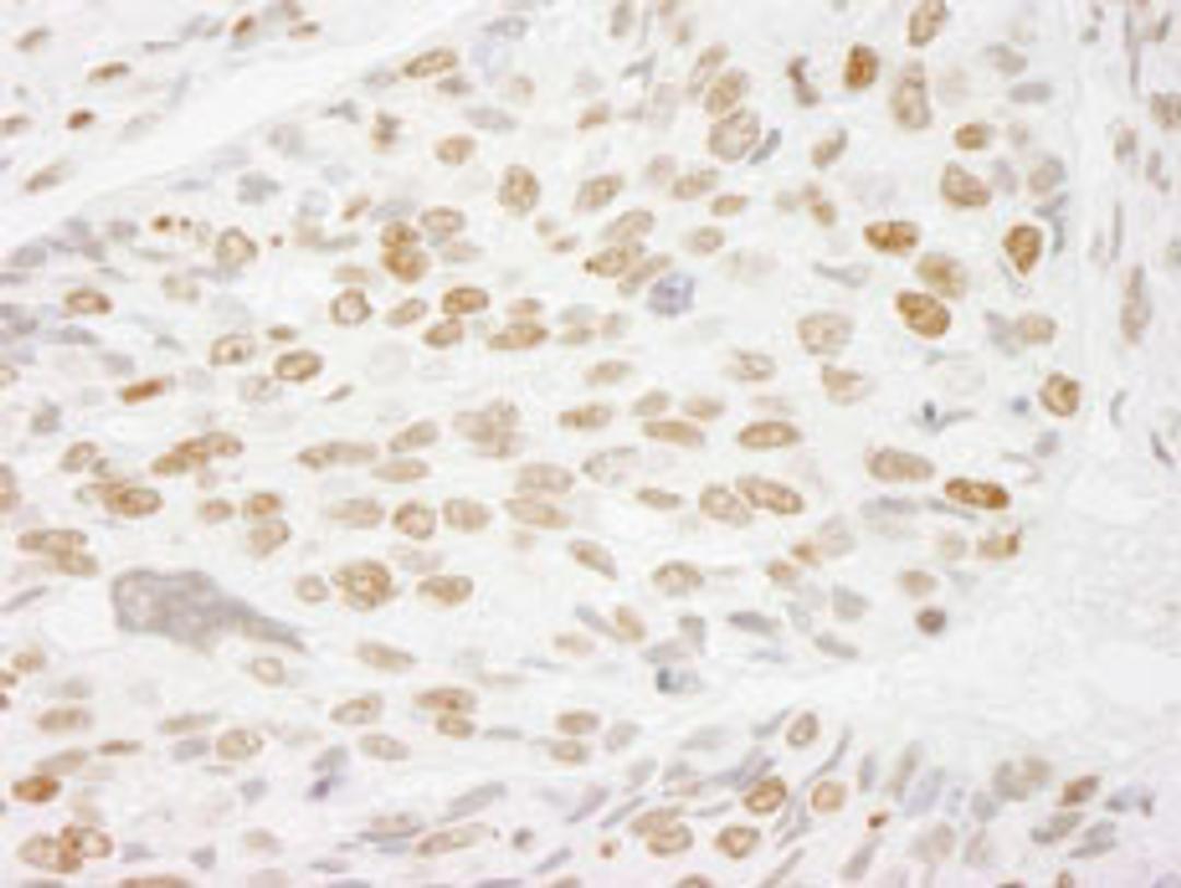 Detection of human Histone H3 by immunohistochemistry.