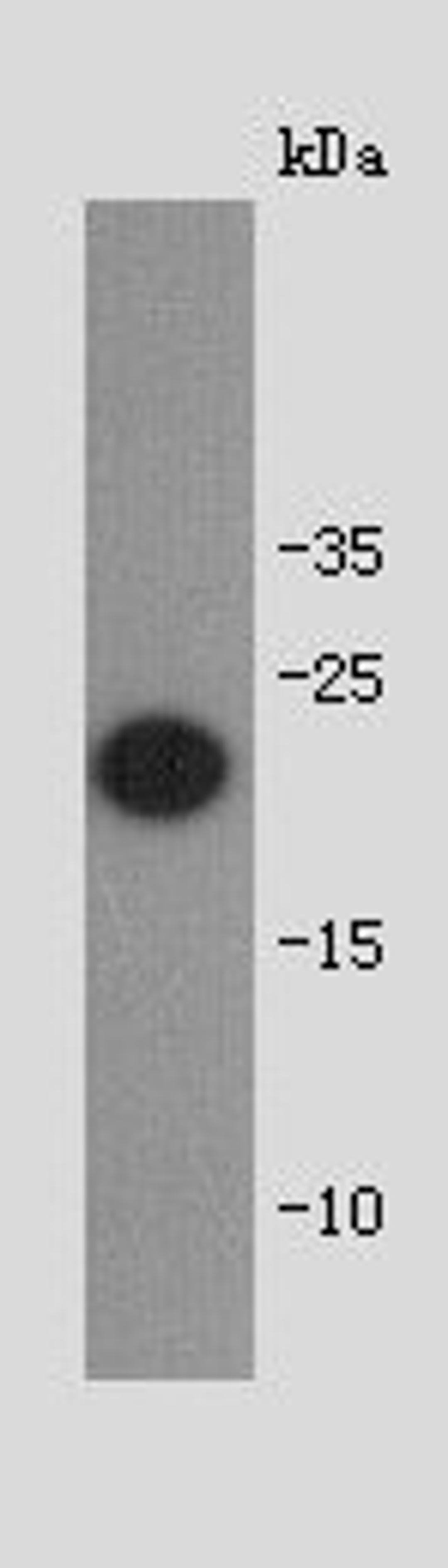 Western blot analysis of full length recombinant protein using shiga toxin subunit B antibody