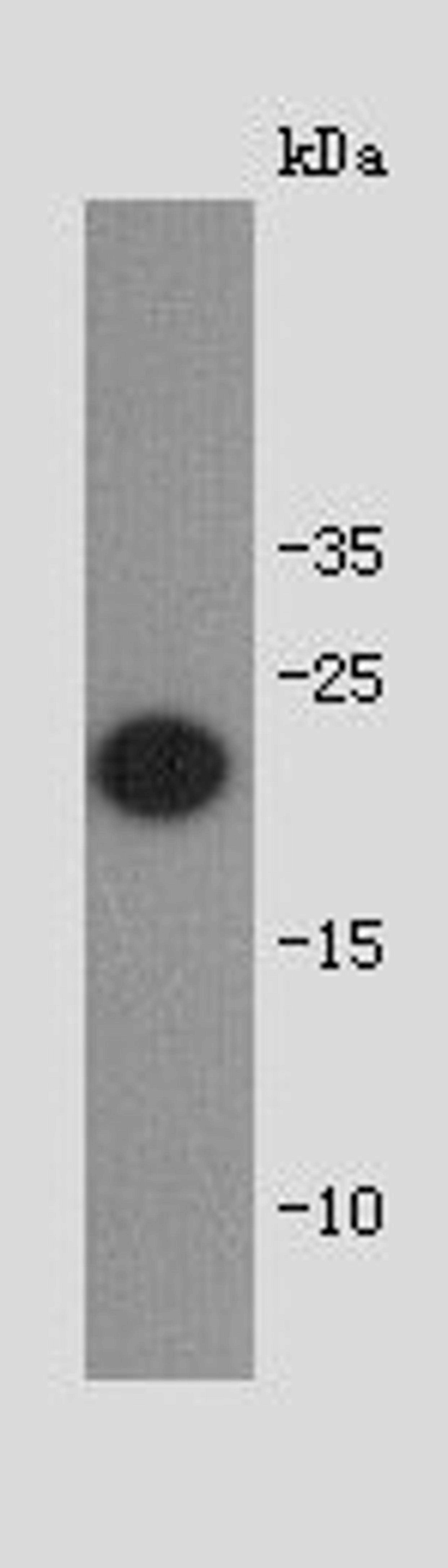 Western blot analysis of full length recombinant protein using shiga toxin subunit B antibody