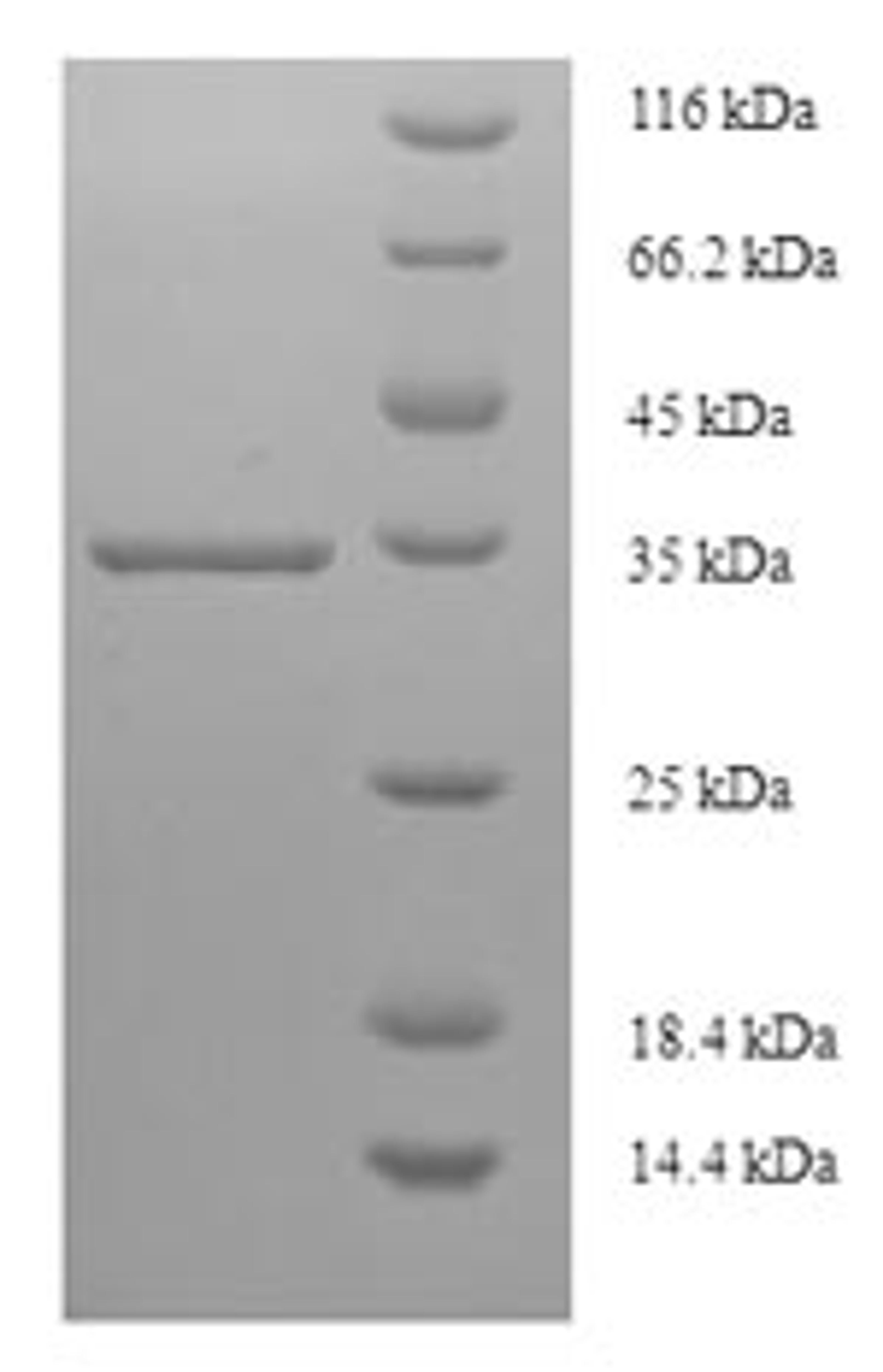 (Tris-Glycine gel) Discontinuous SDS-PAGE (reduced) with 5% enrichment gel and 15% separation gel.