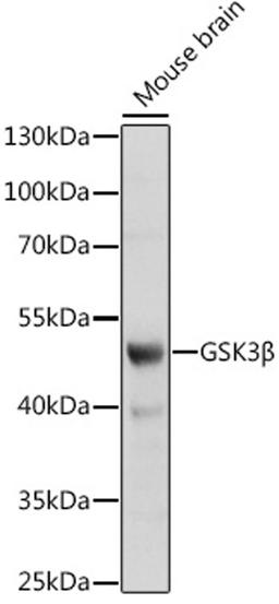 Western blot - GSK3ß antibody (A2081)