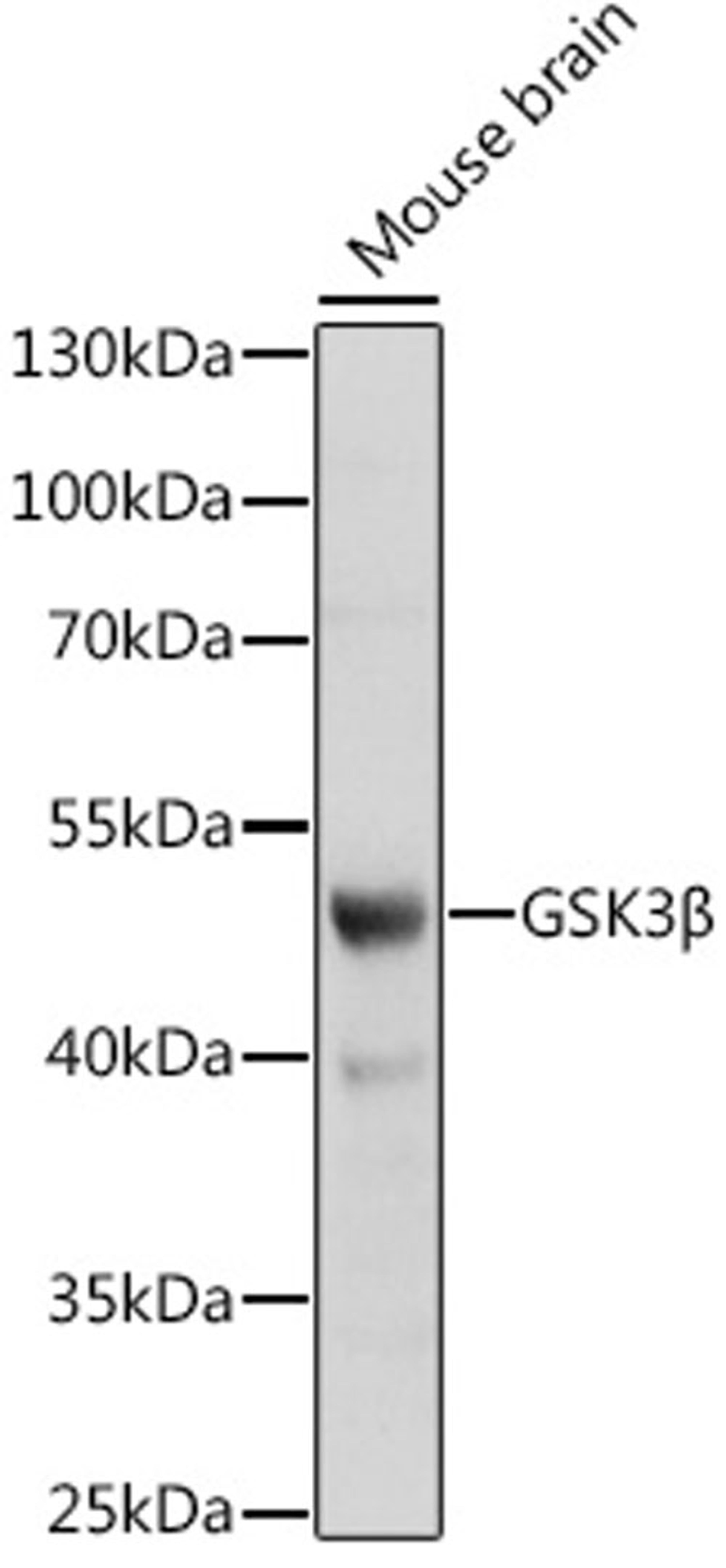 Western blot - GSK3ß antibody (A2081)