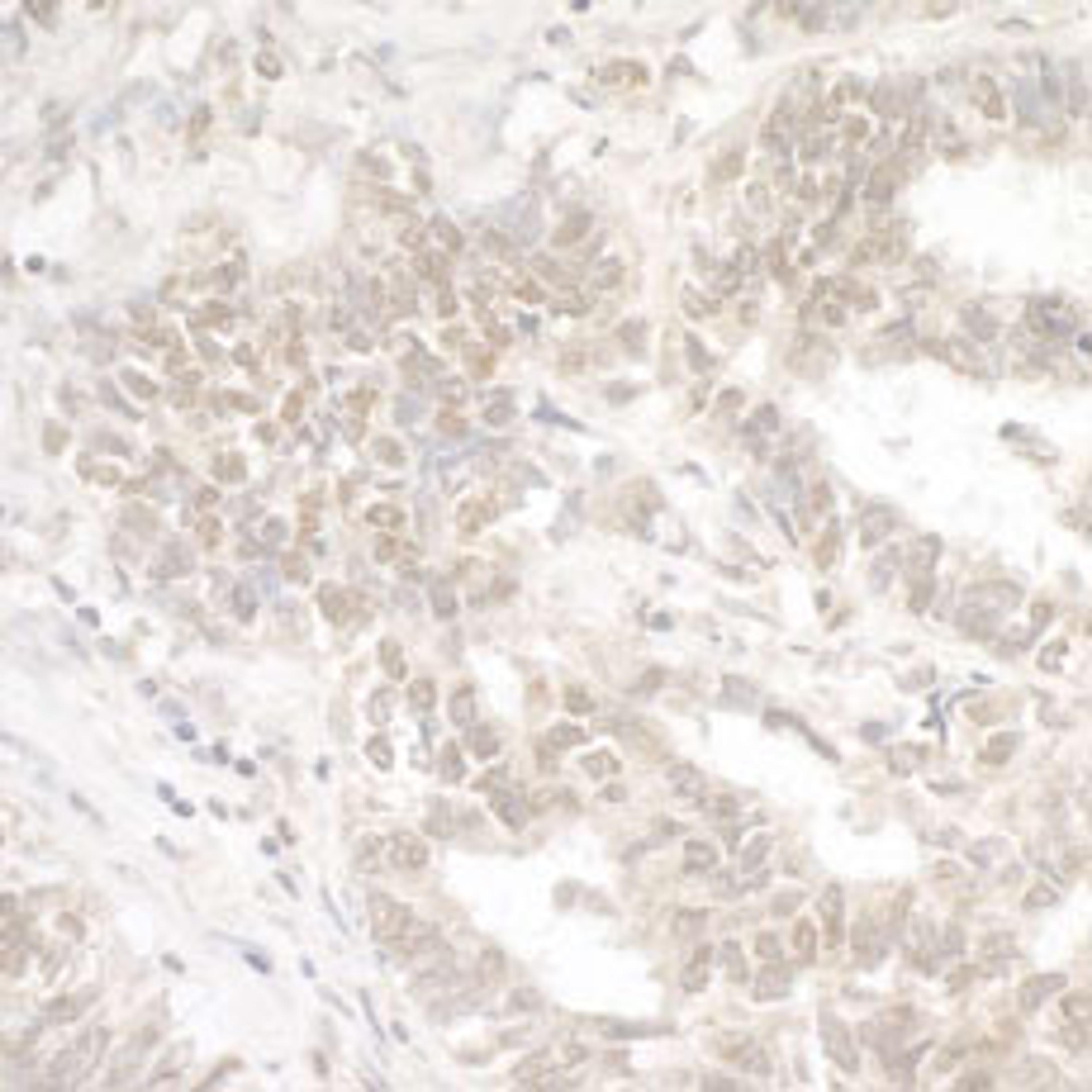 Detection of human G9A/EHMT2 by immunohistochemistry.