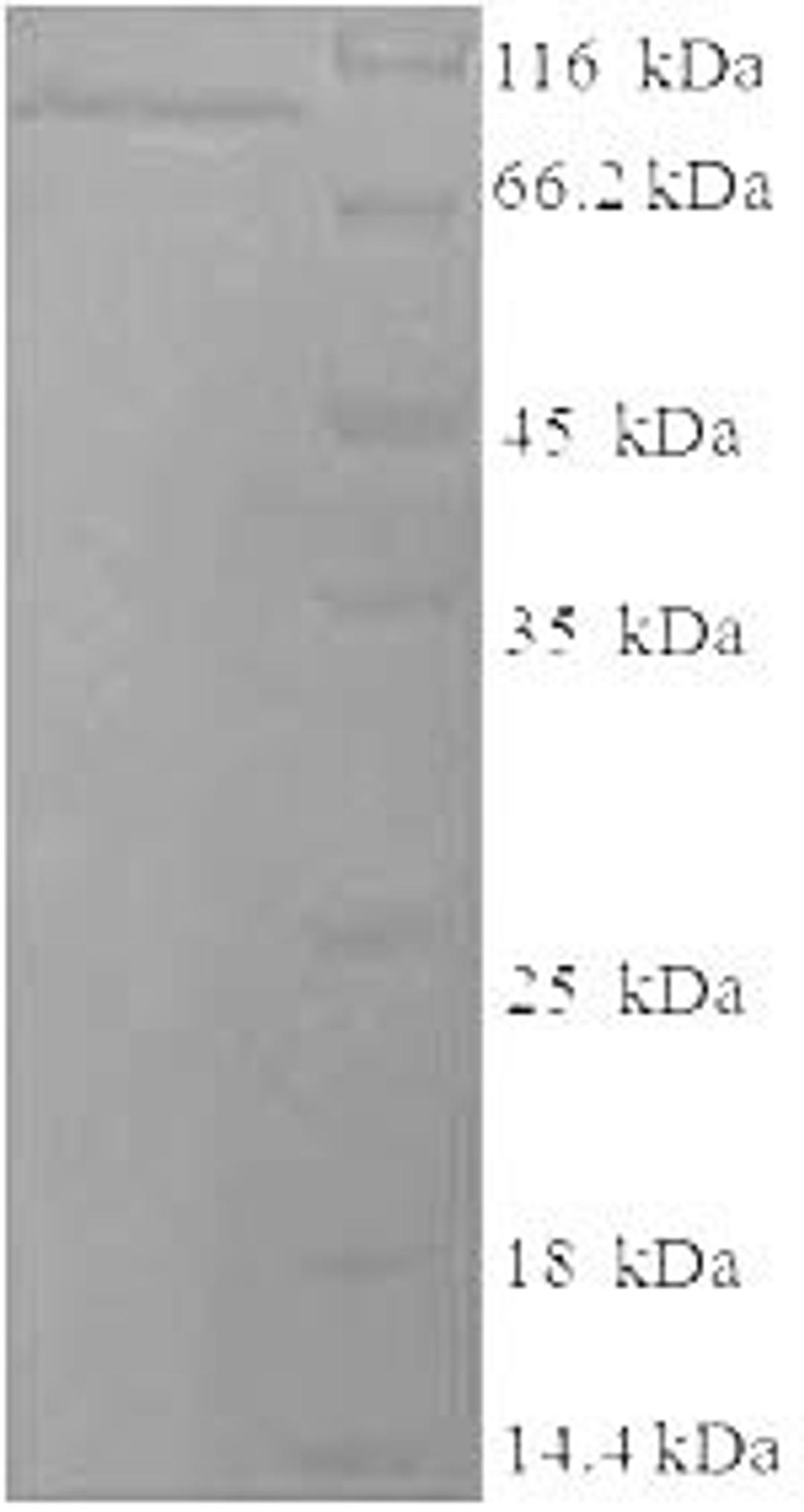(Tris-Glycine gel) Discontinuous SDS-PAGE (reduced) with 5% enrichment gel and 15% separation gel.