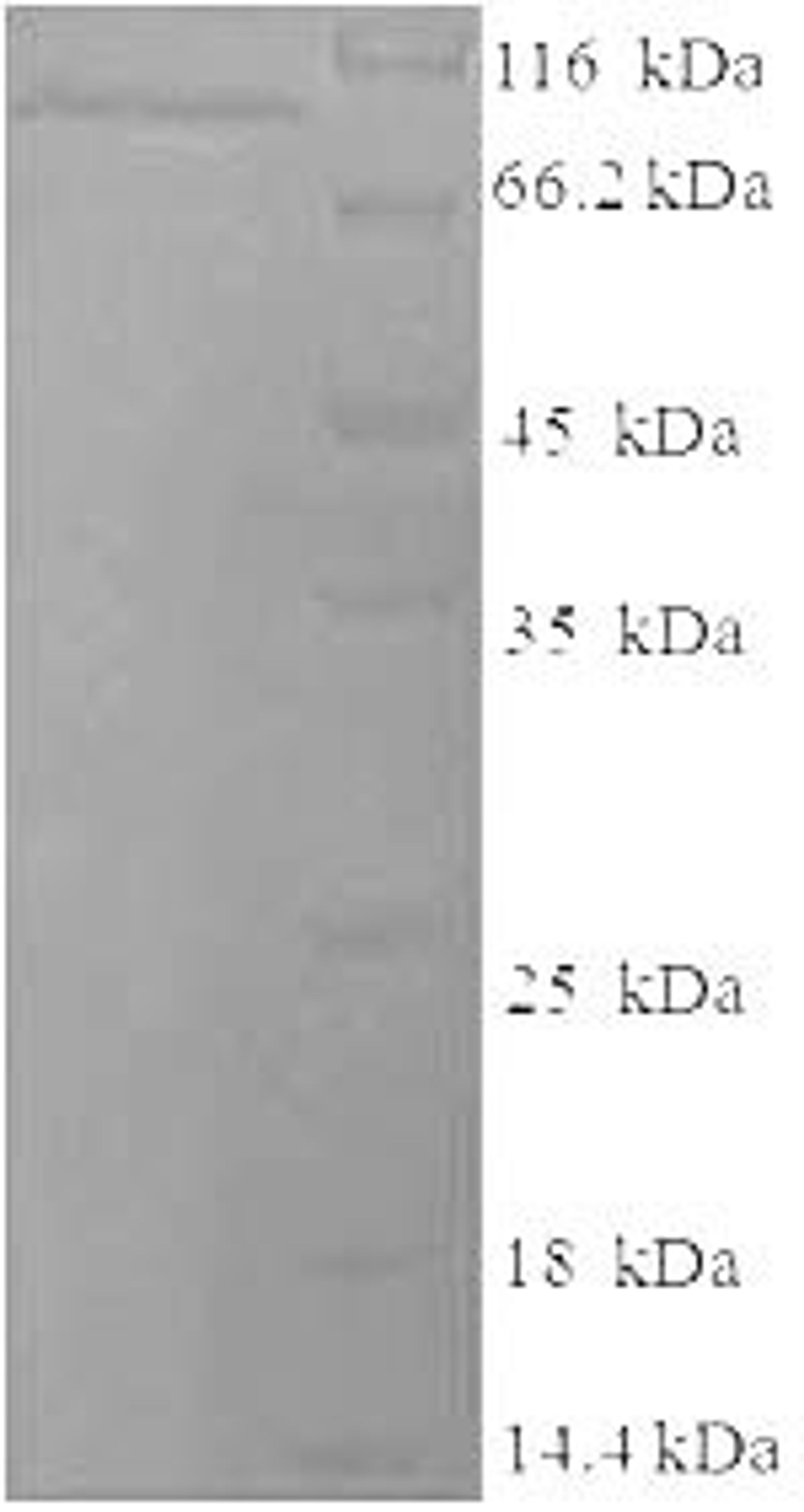 (Tris-Glycine gel) Discontinuous SDS-PAGE (reduced) with 5% enrichment gel and 15% separation gel.