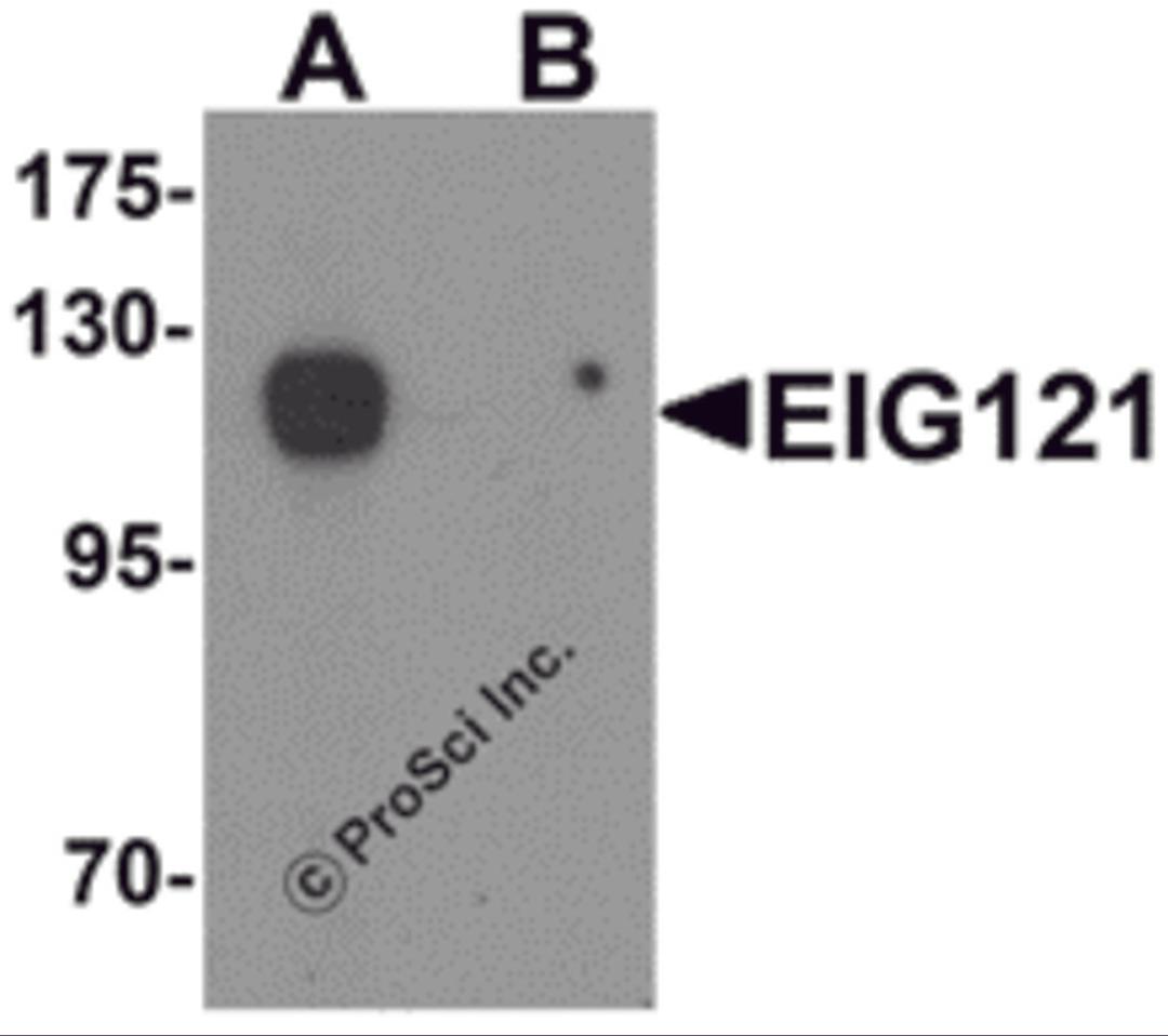 Western blot analysis of EIG121 in MCF7 cell lysate with EIG121 antibody at 1 μg/mL in (A) the absence and (B) the presence of blocking peptide.