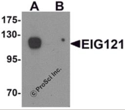 Western blot analysis of EIG121 in MCF7 cell lysate with EIG121 antibody at 1 μg/mL in (A) the absence and (B) the presence of blocking peptide.
