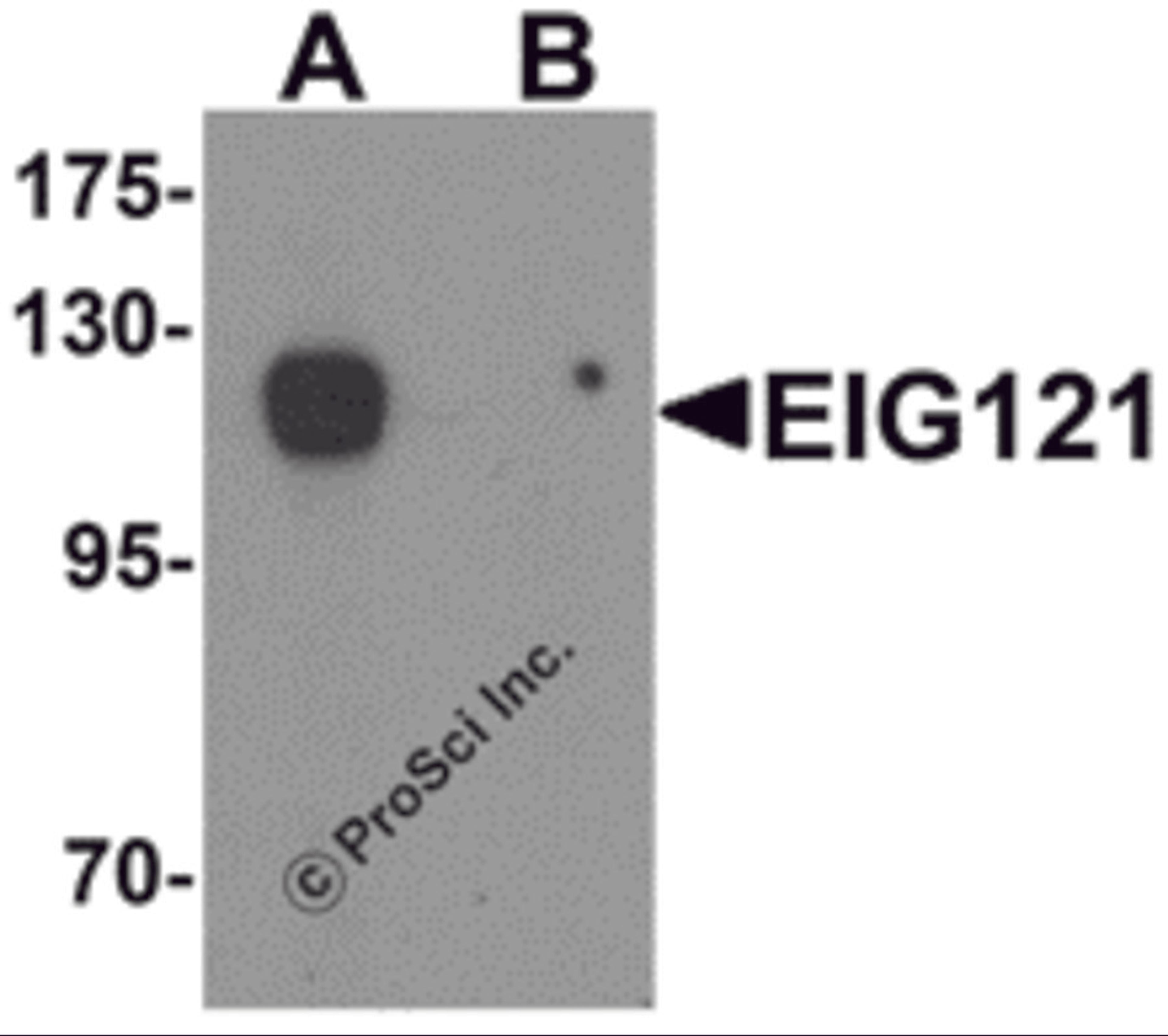 Western blot analysis of EIG121 in MCF7 cell lysate with EIG121 antibody at 1 μg/mL in (A) the absence and (B) the presence of blocking peptide.