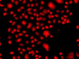 Immunofluorescence - FANCM antibody (A7602)