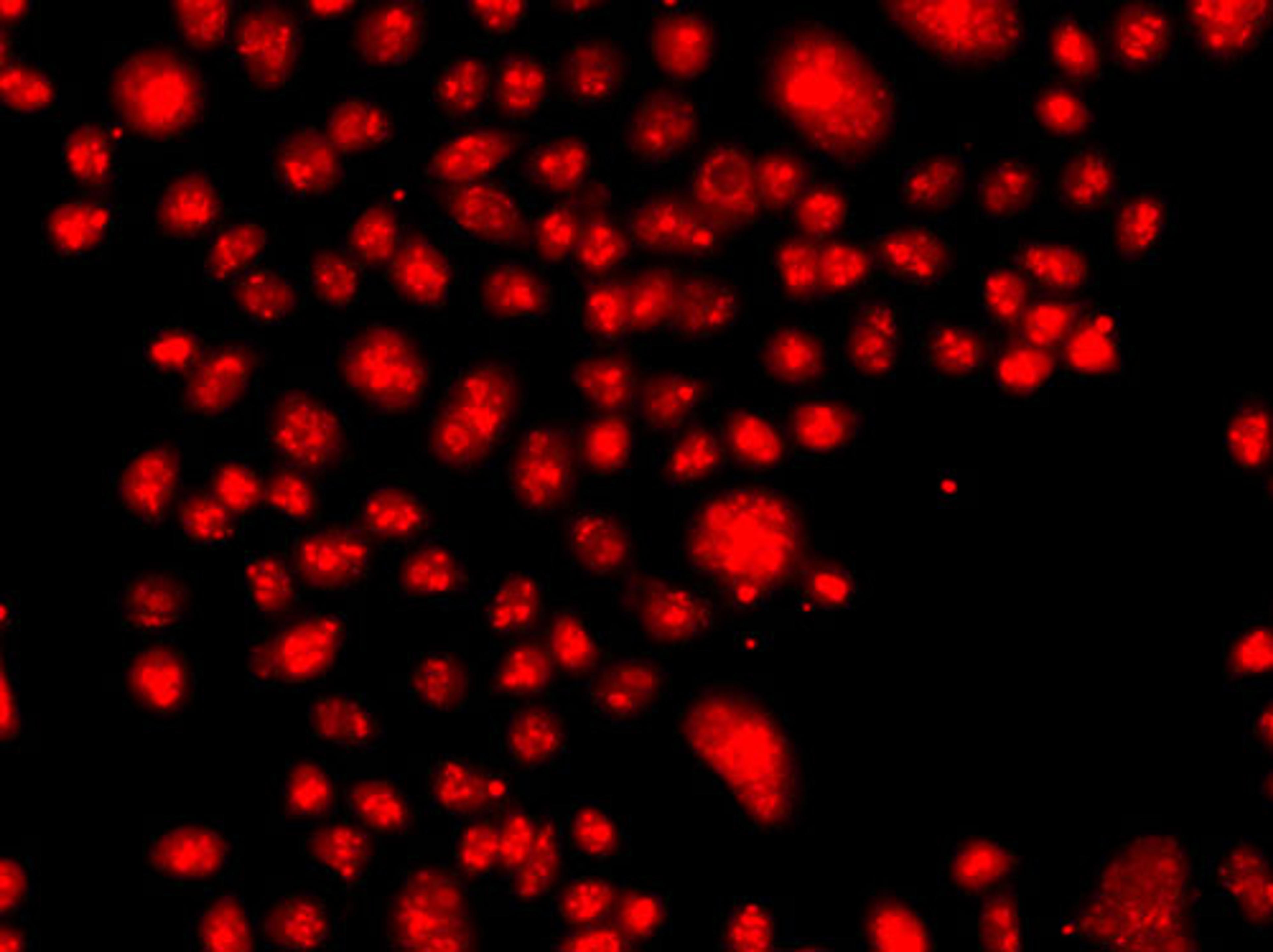 Immunofluorescence - FANCM antibody (A7602)