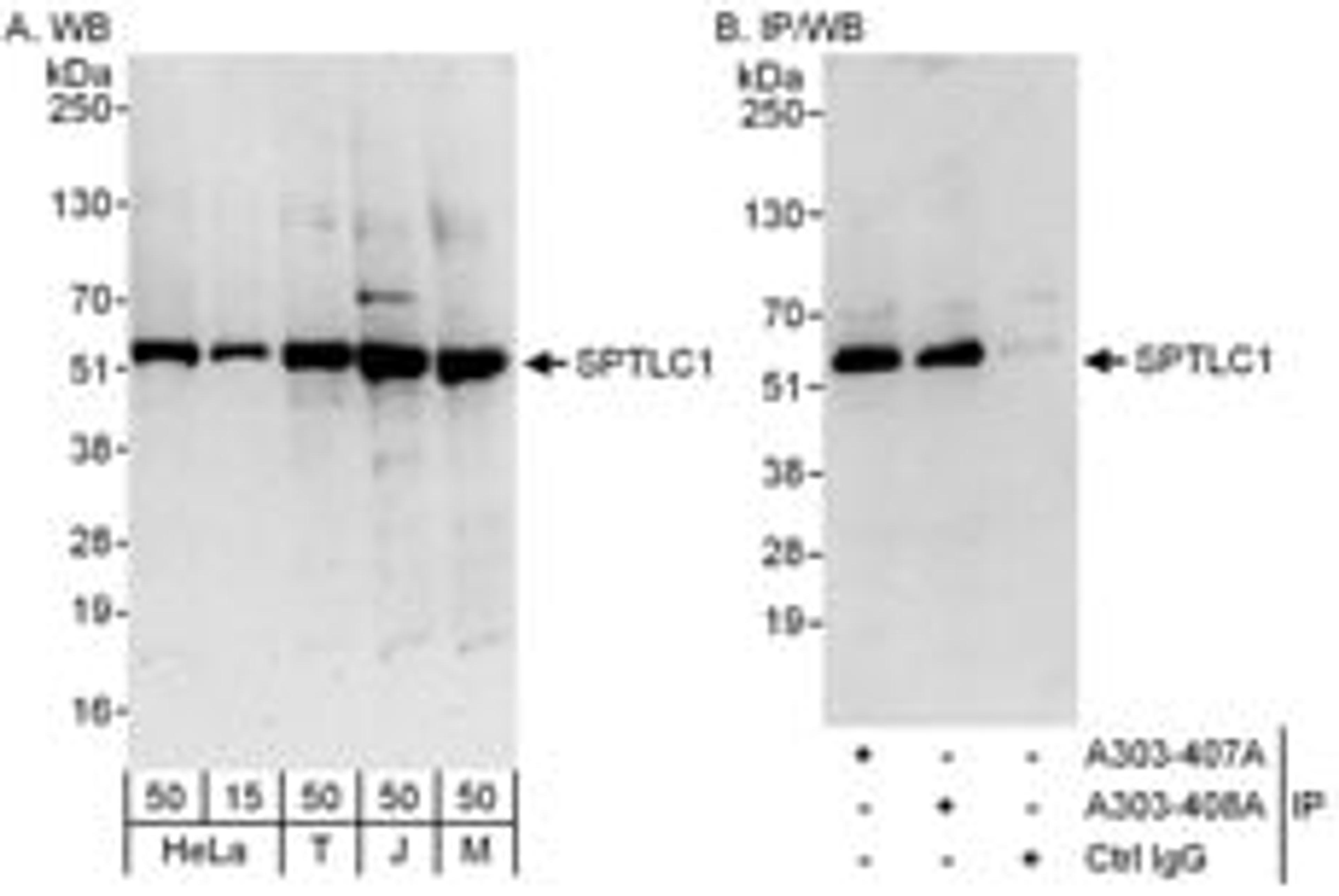 Detection of human and mouse SPTLC1 by western blot (h and m) and immunoprecipitation (h).