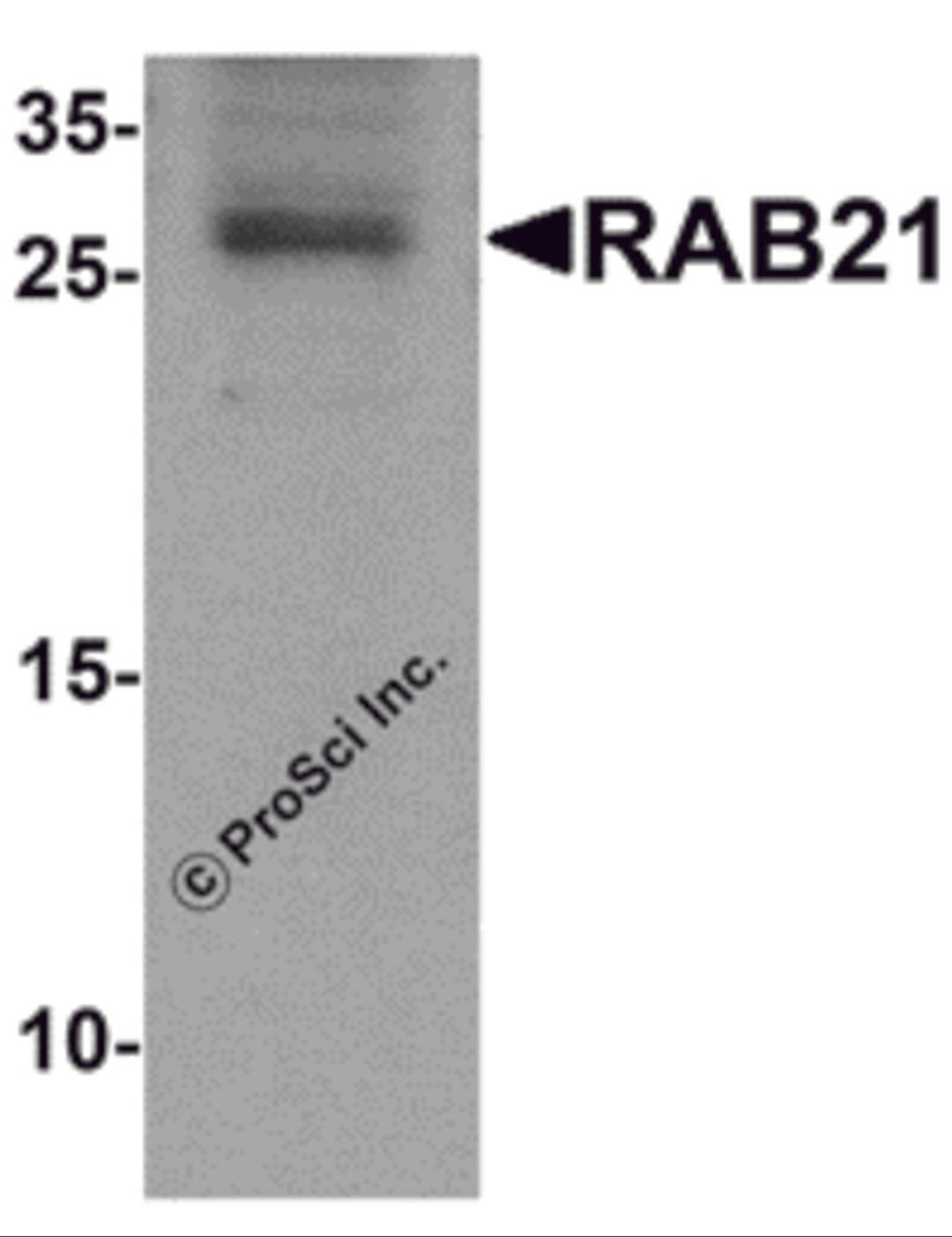 Western blot analysis of RAB21 in mouse kidney tissue lysate with RAB21 antibody at 1 &#956;g/mL.