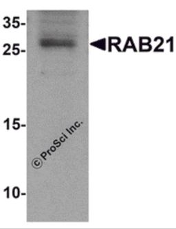 Western blot analysis of RAB21 in mouse kidney tissue lysate with RAB21 antibody at 1 μg/mL.