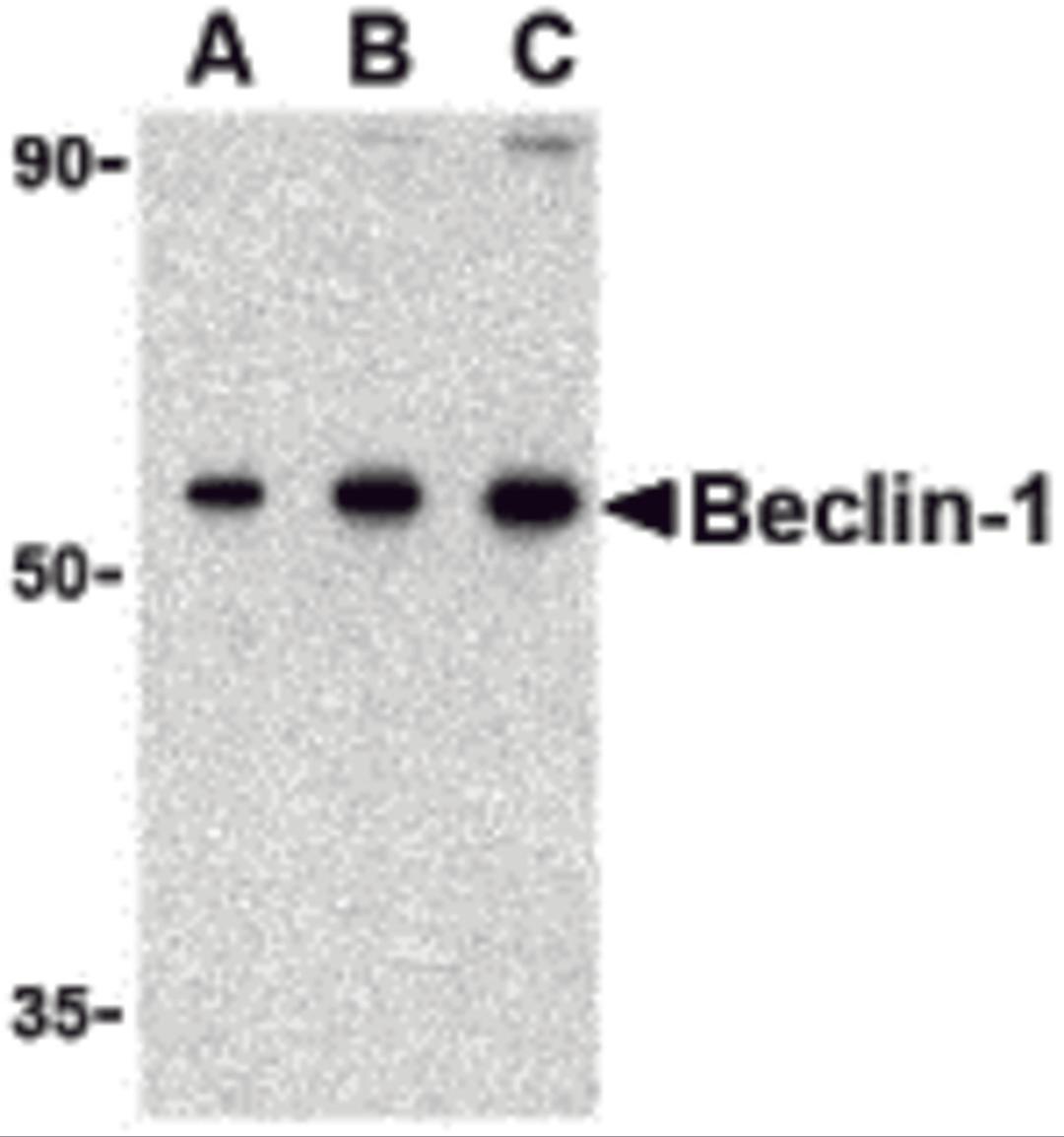 Western blot analysis of Beclin-1 in 293 cell lysate with Beclin-1 antibody at (A) 0.5, (B) 1 and (C) 2 μg/mL.