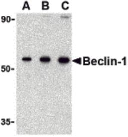 Western blot analysis of Beclin-1 in 293 cell lysate with Beclin-1 antibody at (A) 0.5, (B) 1 and (C) 2 μg/mL.