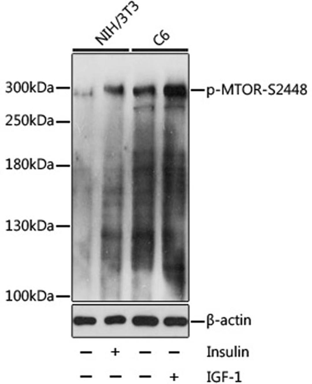 Western blot - Phospho-MTOR-S2448 antibody (AP0094)