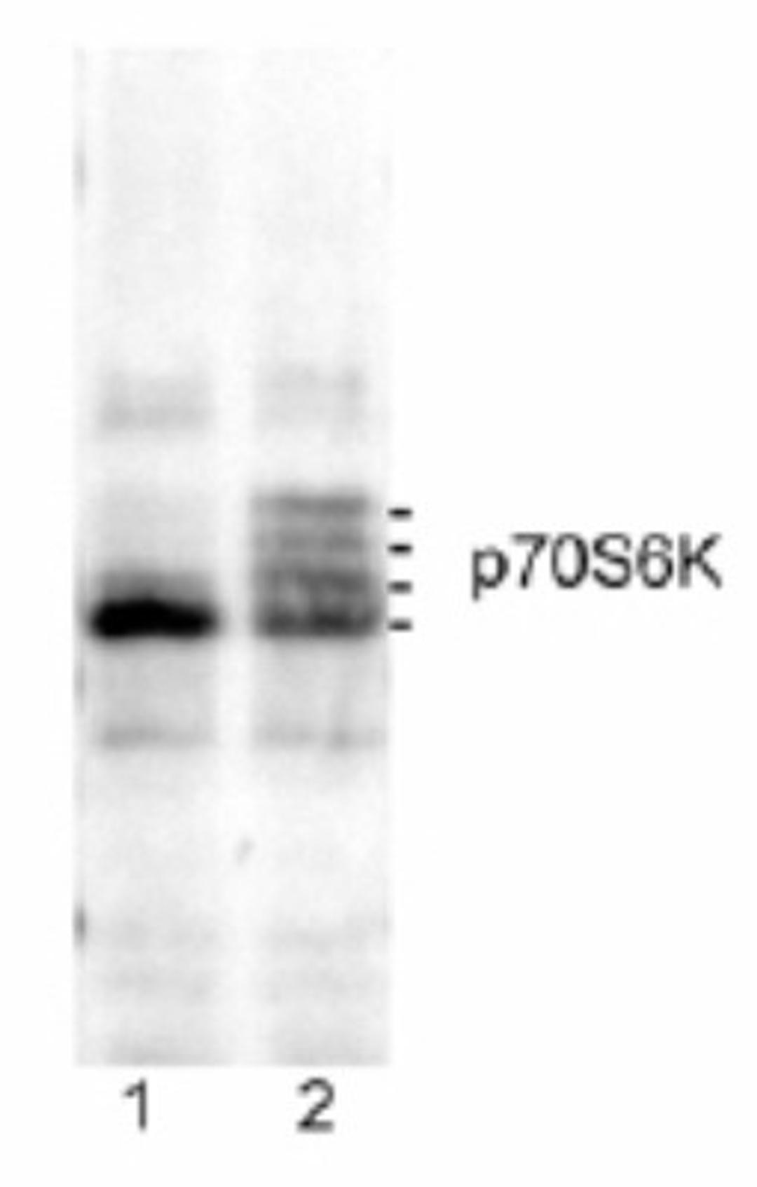 Western Blot: S6K Antibody [NB100-293] - Detection of Rat p70S6 Kinase by Western Blot. Sample:  Lysate from rat L6 myoblast that were serum starved for 1.5 h (lane 1) or serum-deprived for 1 h and then treated with 20 ng/ml IGF-1 for 30 minutes (lane 2).  Antibody:  Affinity purified rabbit anti-p70S6 kinase (NB100-293) used at 0.1 mcg/ml.  Detection:  Chemiluminescence.