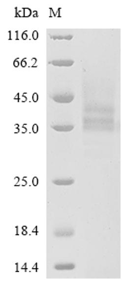 (Tris-Glycine gel) Discontinuous SDS-PAGE (reduced) with 5% enrichment gel and 15% separation gel.