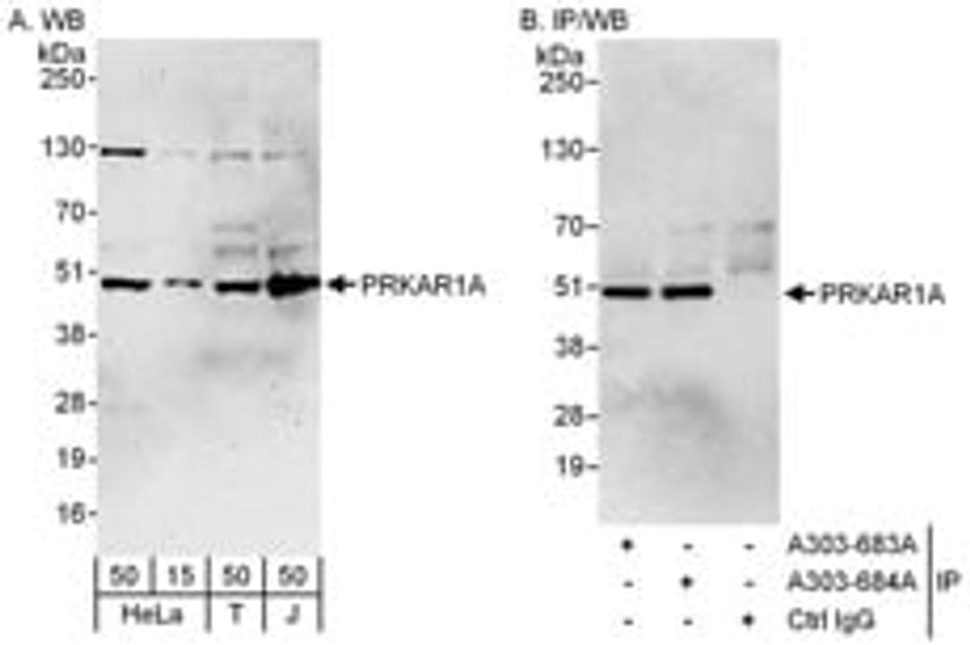 Detection of human PRKAR1A by western blot and immunoprecipitation.