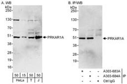 Detection of human PRKAR1A by western blot and immunoprecipitation.