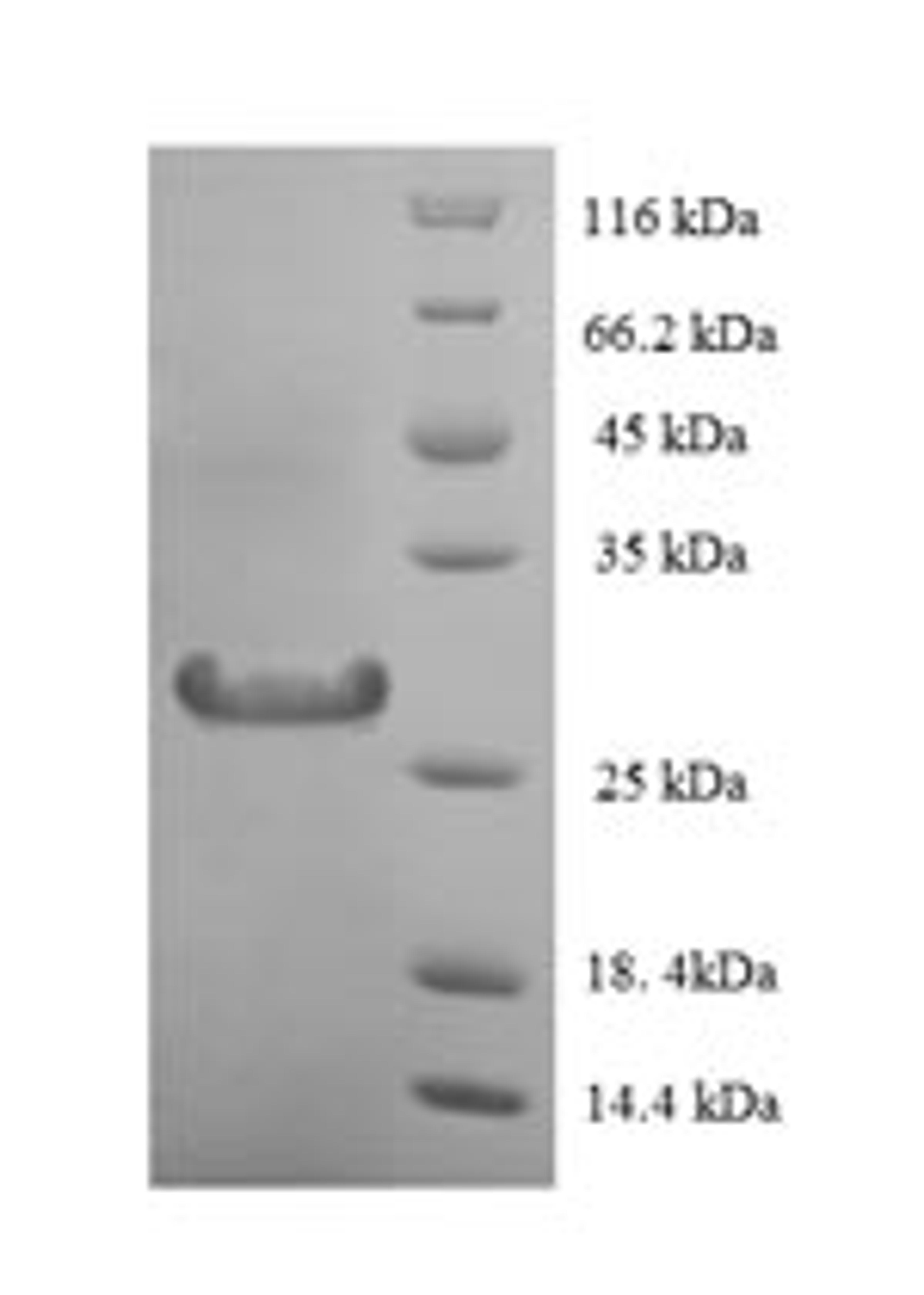 (Tris-Glycine gel) Discontinuous SDS-PAGE (reduced) with 5% enrichment gel and 15% separation gel.