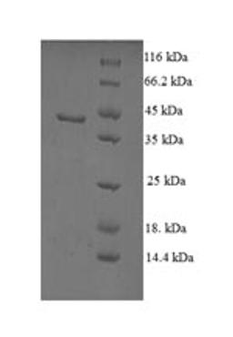 (Tris-Glycine gel) Discontinuous SDS-PAGE (reduced) with 5% enrichment gel and 15% separation gel.