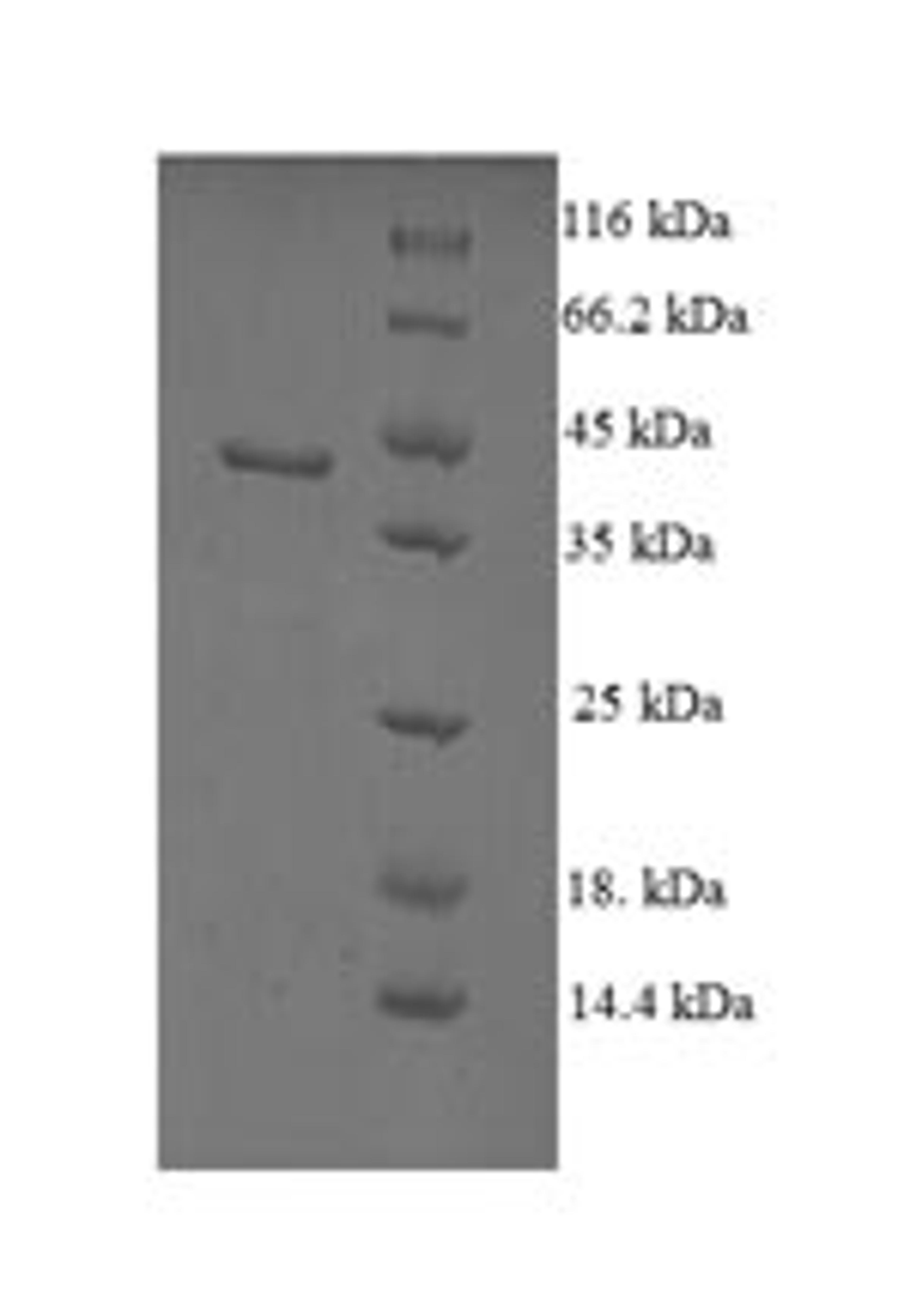 (Tris-Glycine gel) Discontinuous SDS-PAGE (reduced) with 5% enrichment gel and 15% separation gel.
