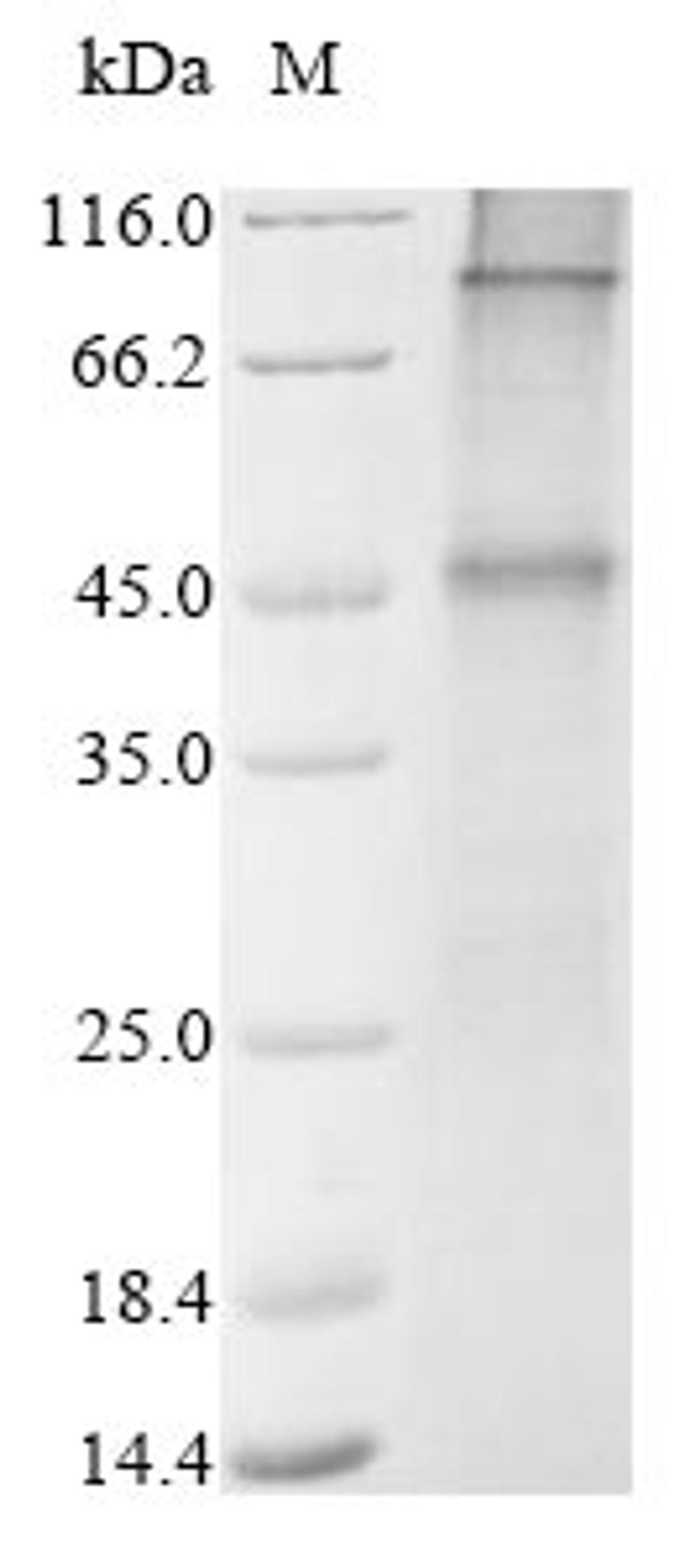 (Tris-Glycine gel) Discontinuous SDS-PAGE (reduced) with 5% enrichment gel and 15% separation gel.