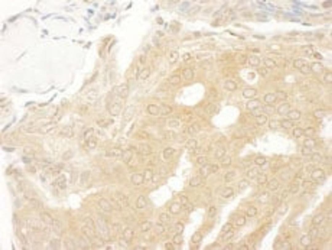 Detection of human MEK2 by immunohistochemistry.