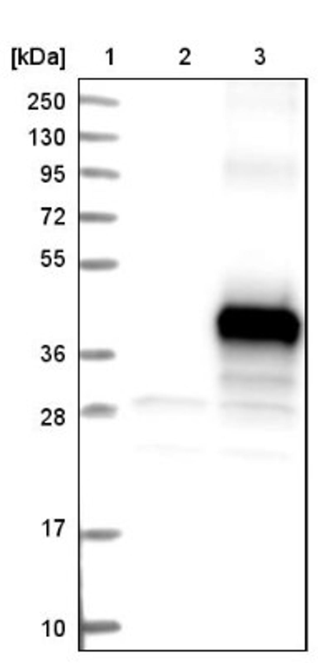 Western Blot: C9orf91 Antibody [NBP1-90535] - Lane 1: Marker [kDa] 250, 130, 95, 72, 55, 36, 28, 17, 10<br/>Lane 2: Negative control (vector only transfected HEK293T lysate)<br/>Lane 3: Over-expression lysate (Co-expressed with a C-terminal myc-DDK tag (~3.1 kDa) in mammalian HEK293T cells, LY407032)