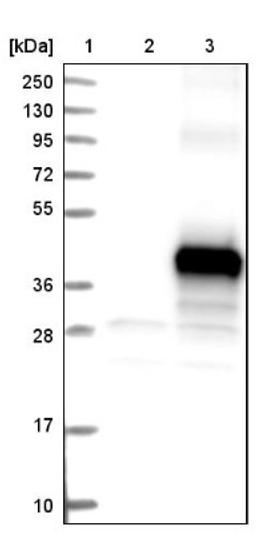 Western Blot: C9orf91 Antibody [NBP1-90535] - Lane 1: Marker [kDa] 250, 130, 95, 72, 55, 36, 28, 17, 10<br/>Lane 2: Negative control (vector only transfected HEK293T lysate)<br/>Lane 3: Over-expression lysate (Co-expressed with a C-terminal myc-DDK tag (~3.1 kDa) in mammalian HEK293T cells, LY407032)