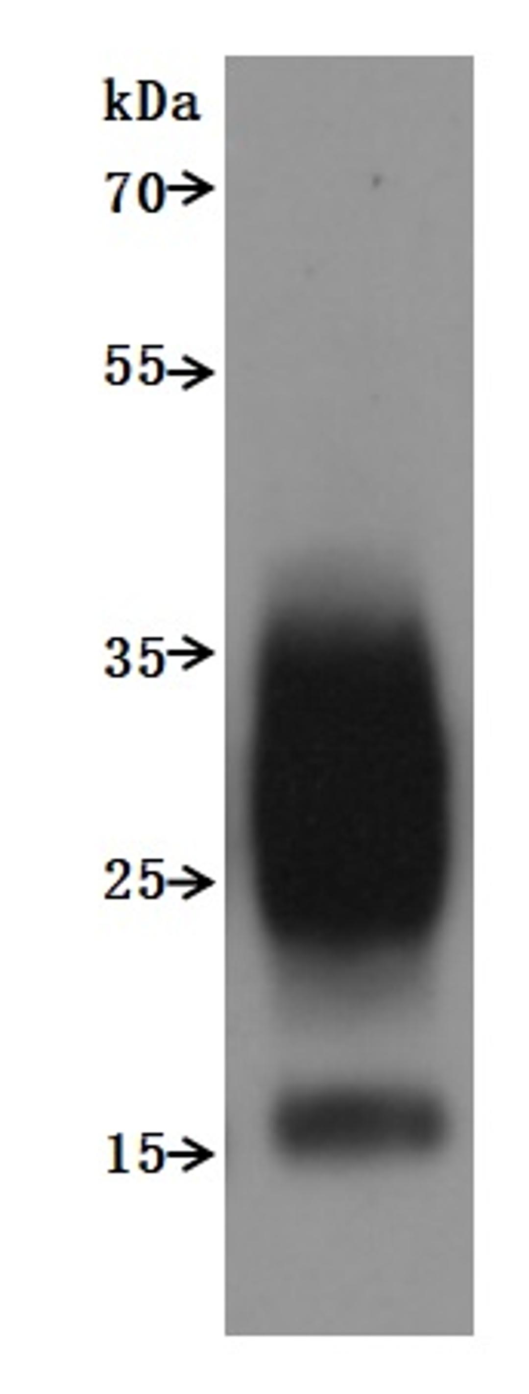CSB-MP023615HU is detected by Mouse anti-6*His monoclonal antibody.The two bands respectively correspond to monomer, Homodimer.