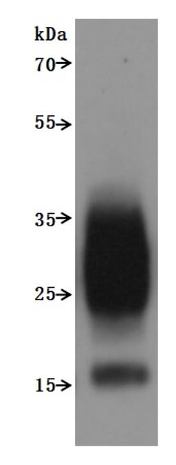 CSB-MP023615HU is detected by Mouse anti-6*His monoclonal antibody.The two bands respectively correspond to monomer, Homodimer.