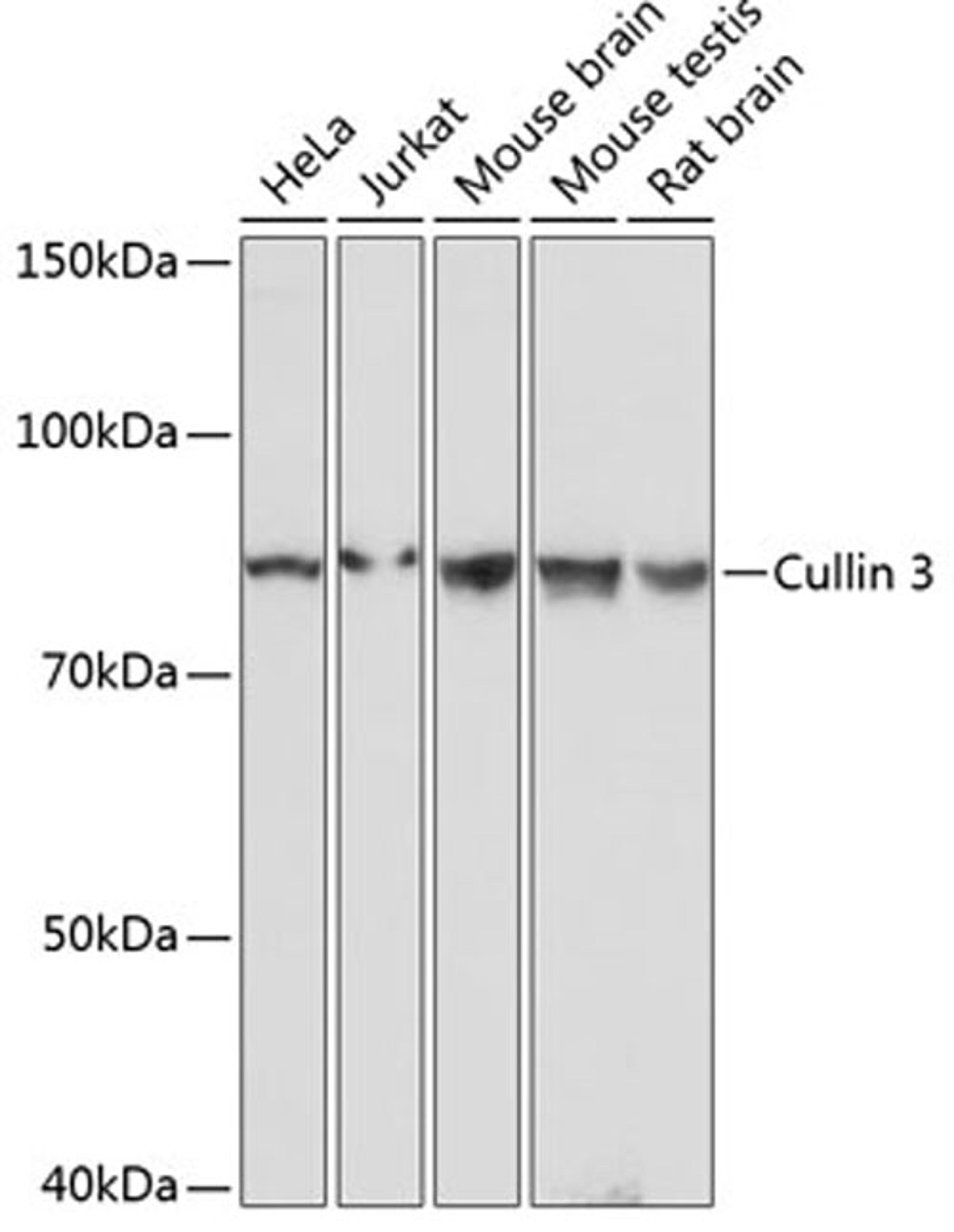 Western blot - Cullin 3 antibody (A19623)