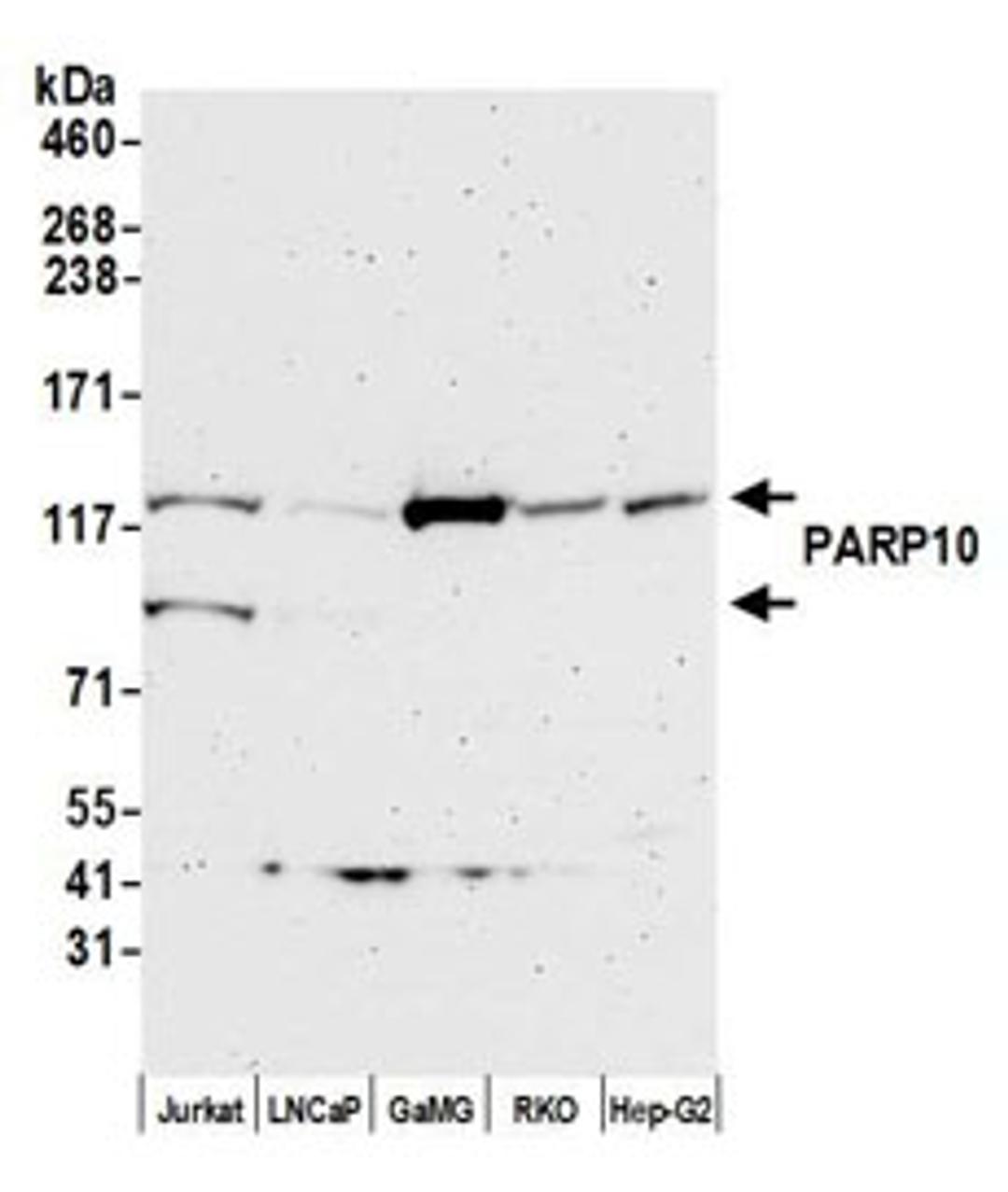 Detection of human PARP10 by western blot.