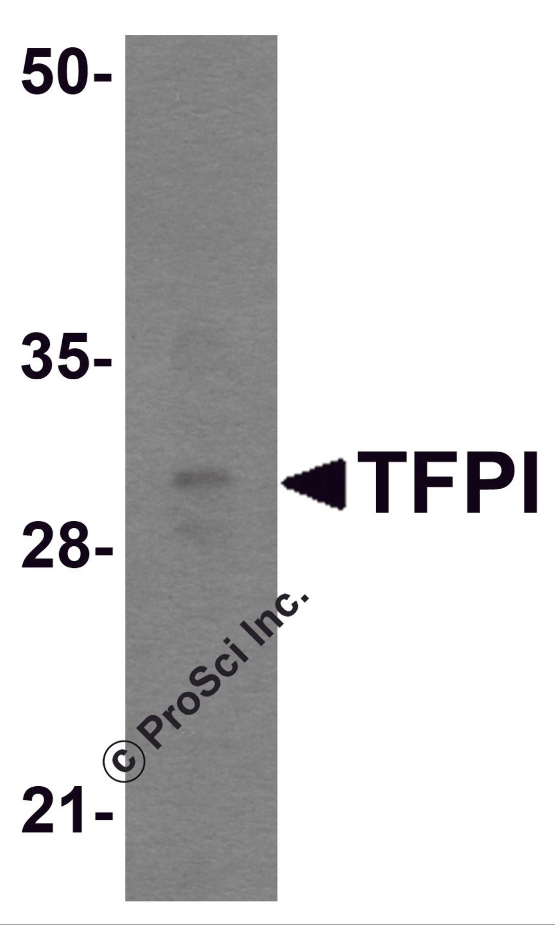 Western blot analysis of TFPI in rat small intestine tissue lysate with TFPI antibody at 1 &#956;g/mL.