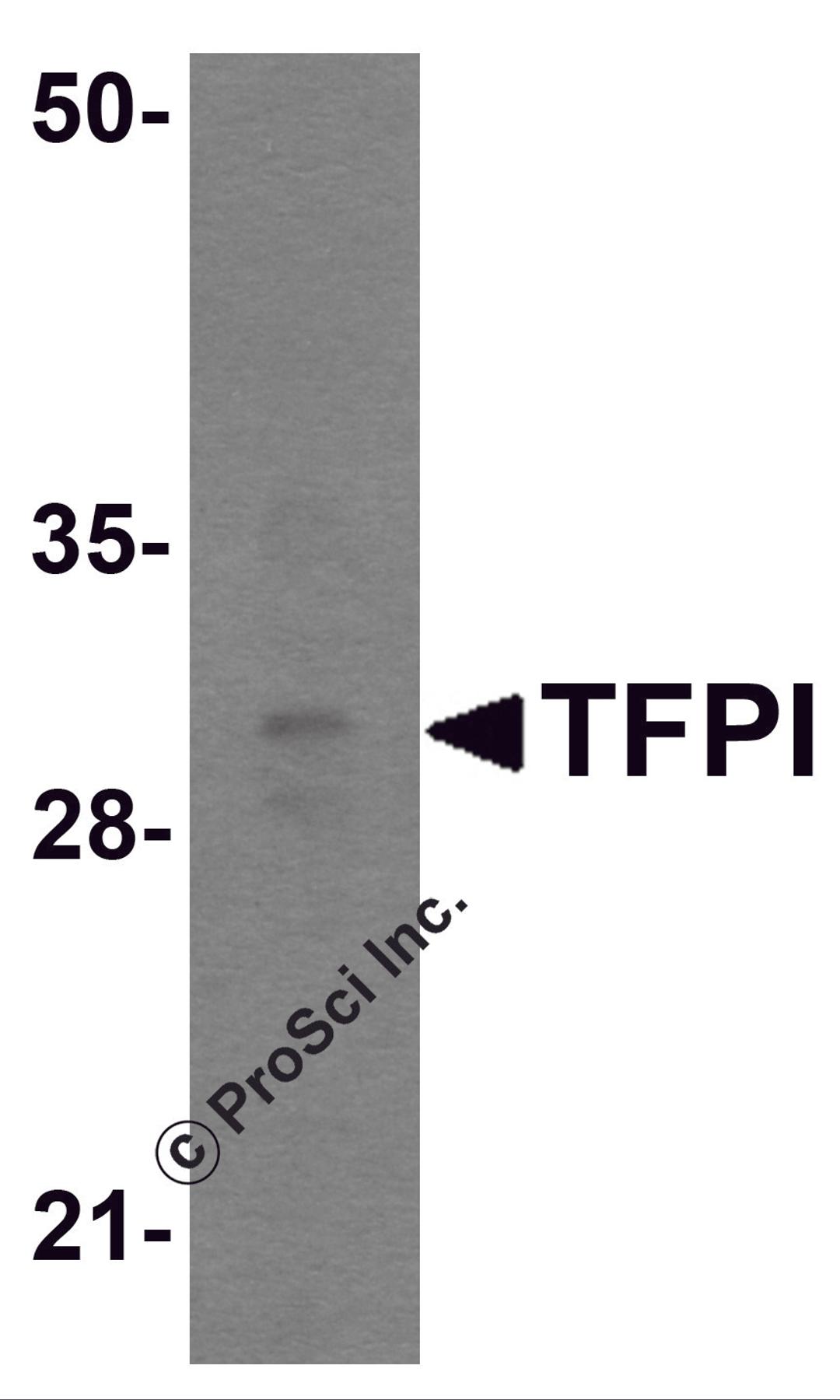 Western blot analysis of TFPI in rat small intestine tissue lysate with TFPI antibody at 1 μg/mL.