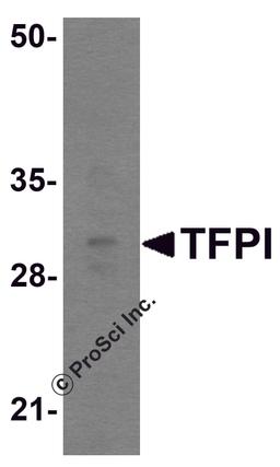 Western blot analysis of TFPI in rat small intestine tissue lysate with TFPI antibody at 1 μg/mL.