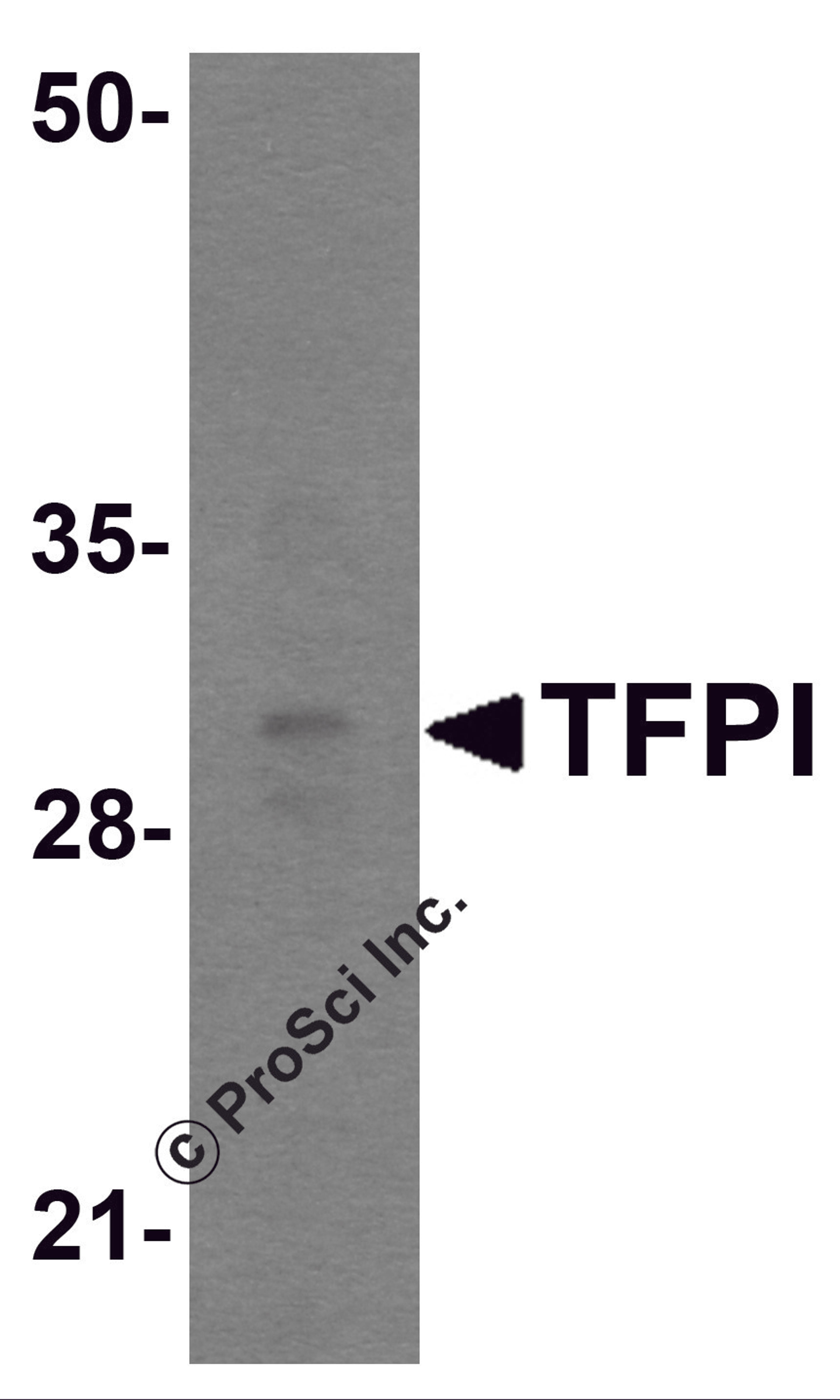 Western blot analysis of TFPI in rat small intestine tissue lysate with TFPI antibody at 1 μg/mL.