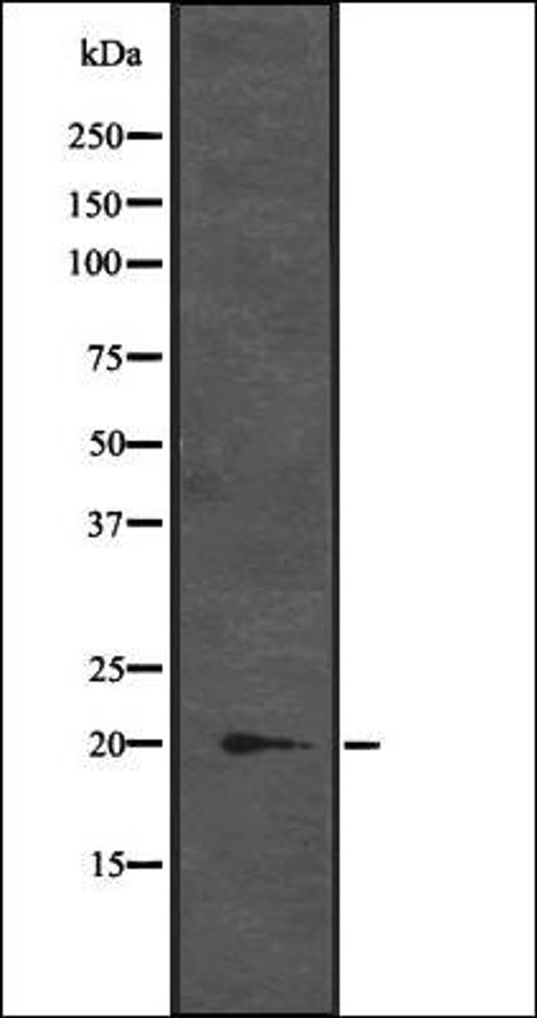 Western blot analysis of K-562 cell lysate at 25ug/lane using CENPM antibody