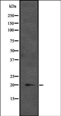 Western blot analysis of K-562 cell lysate at 25ug/lane using CENPM antibody