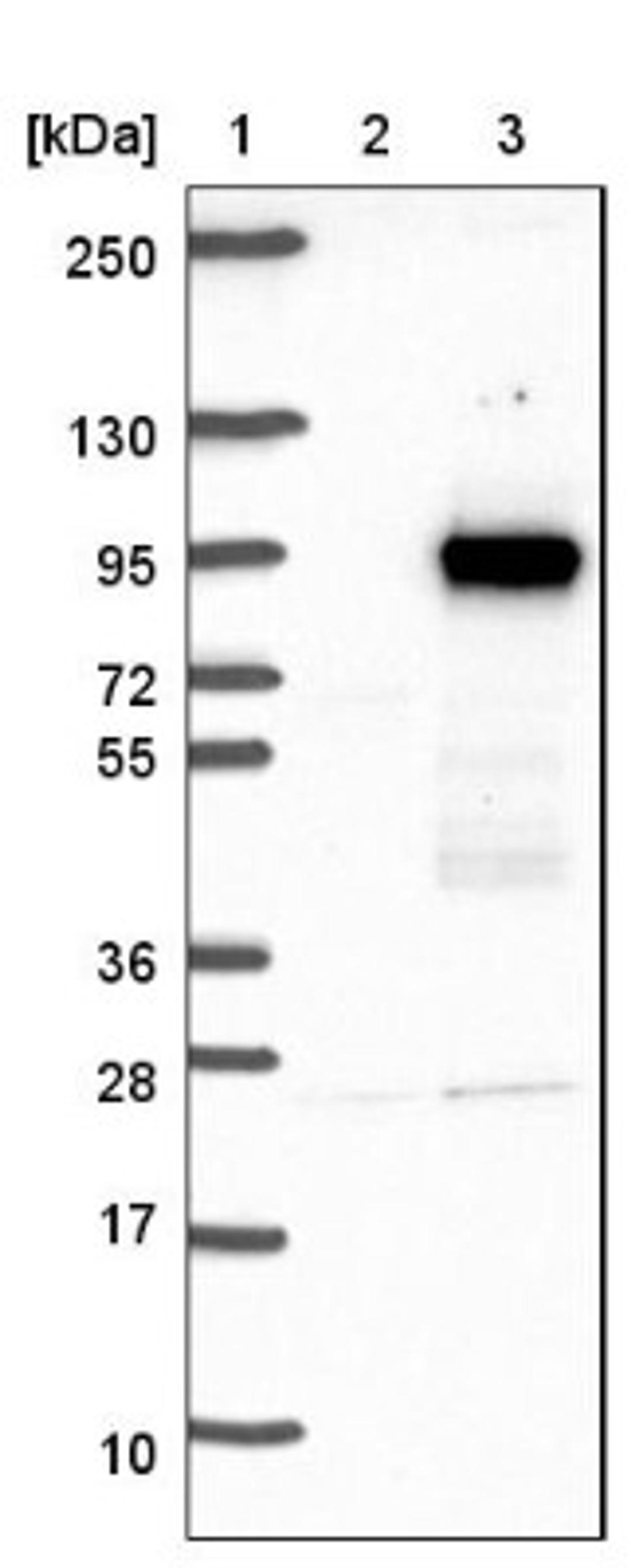 Western Blot: KLHL11 Antibody [NBP1-83846] - Lane 1: Marker [kDa] 250, 130, 95, 72, 55, 36, 28, 17, 10<br/>Lane 2: Negative control (vector only transfected HEK293T lysate)<br/>Lane 3: Over-expression lysate (Co-expressed with a C-terminal myc-DDK tag (~3.1 kDa) in mammalian HEK293T cells, LY413273)