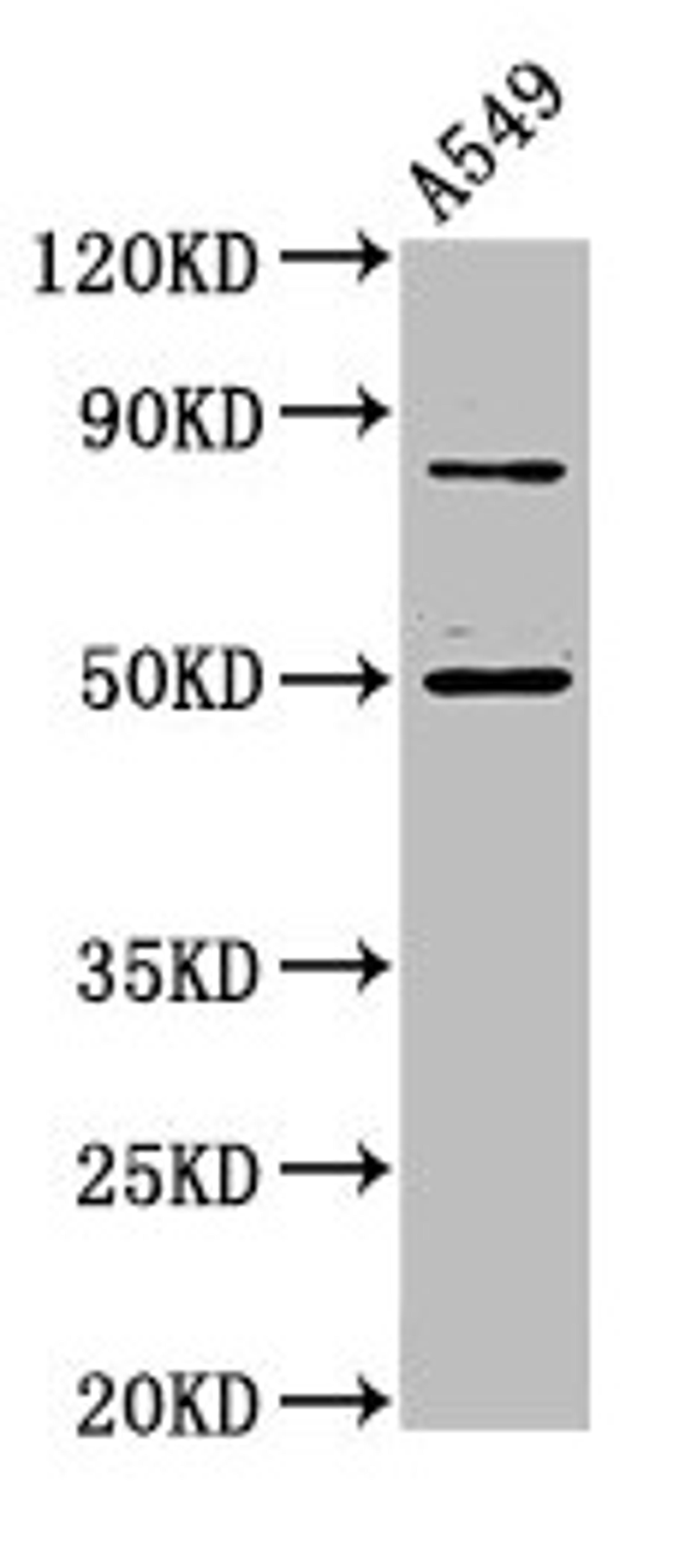 Western Blot. Positive WB detected in: A549 whole cell lysate. All lanes: LRRFIP2 antibody at 4.8µg/ml. Secondary. Goat polyclonal to rabbit IgG at 1/50000 dilution. Predicted band size: 83, 46, 12, 49, 58 kDa. Observed band size: 83, 49 kDa