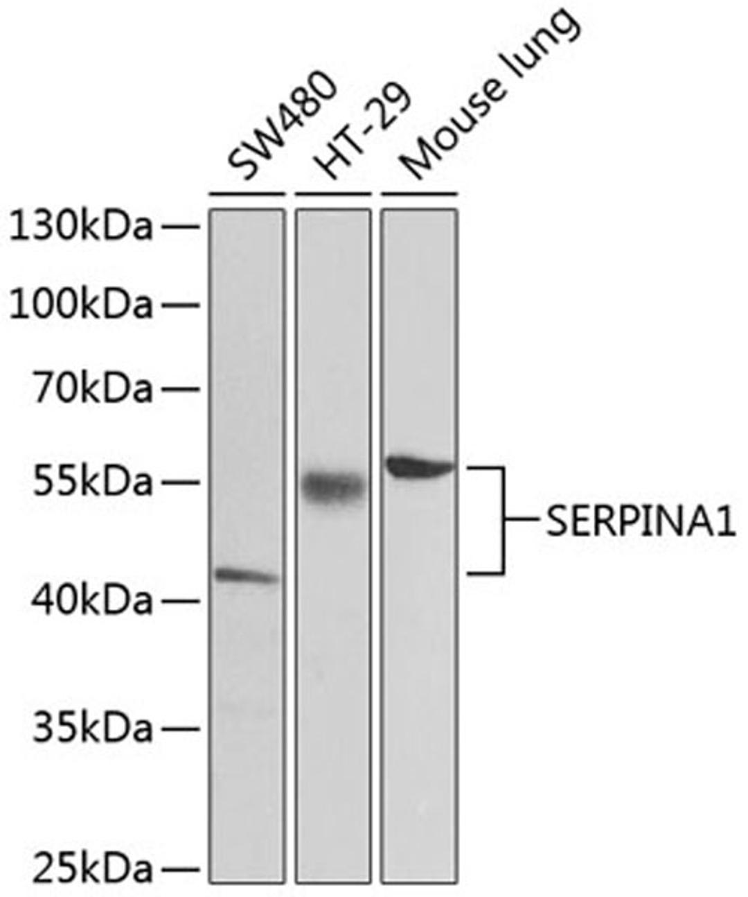 Western blot - SERPINA1 antibody (A12481)