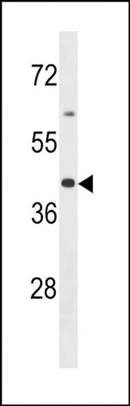 Western blot analysis in MDA-MB453 cell line lysates (35ug/lane).