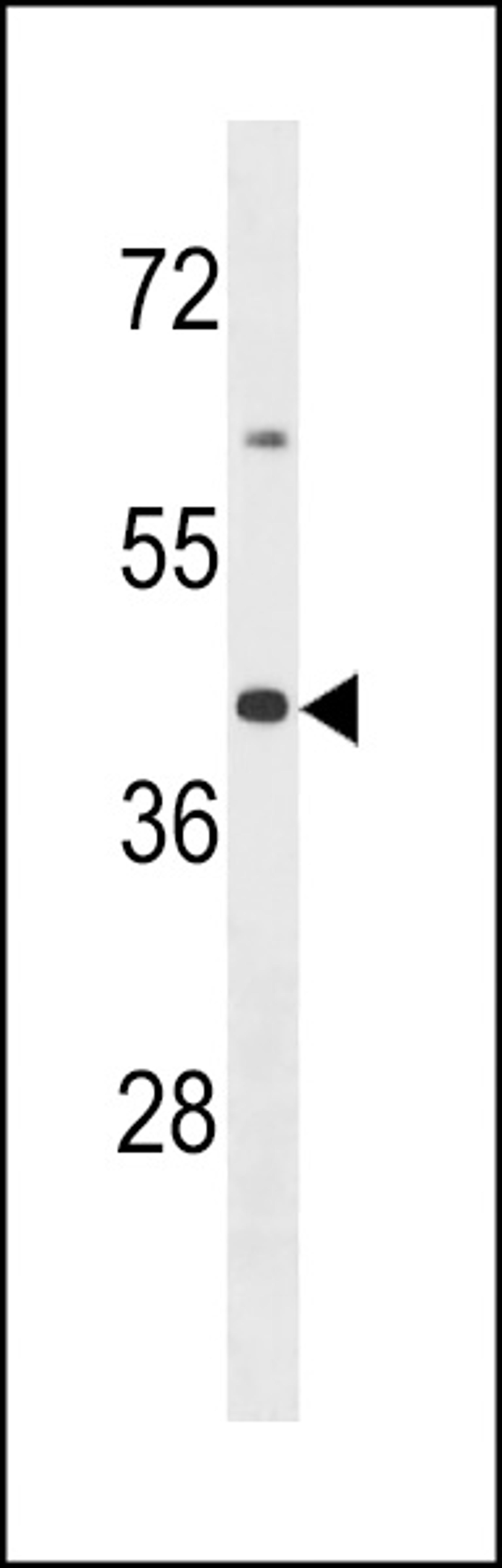 Western blot analysis in MDA-MB453 cell line lysates (35ug/lane).