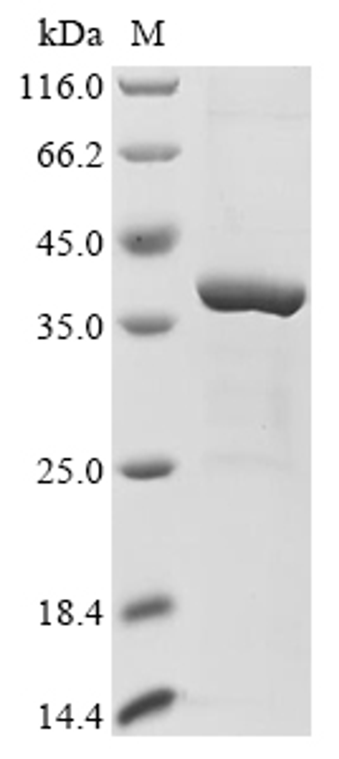 (Tris-Glycine gel) Discontinuous SDS-PAGE (reduced) with 5% enrichment gel and 15% separation gel.