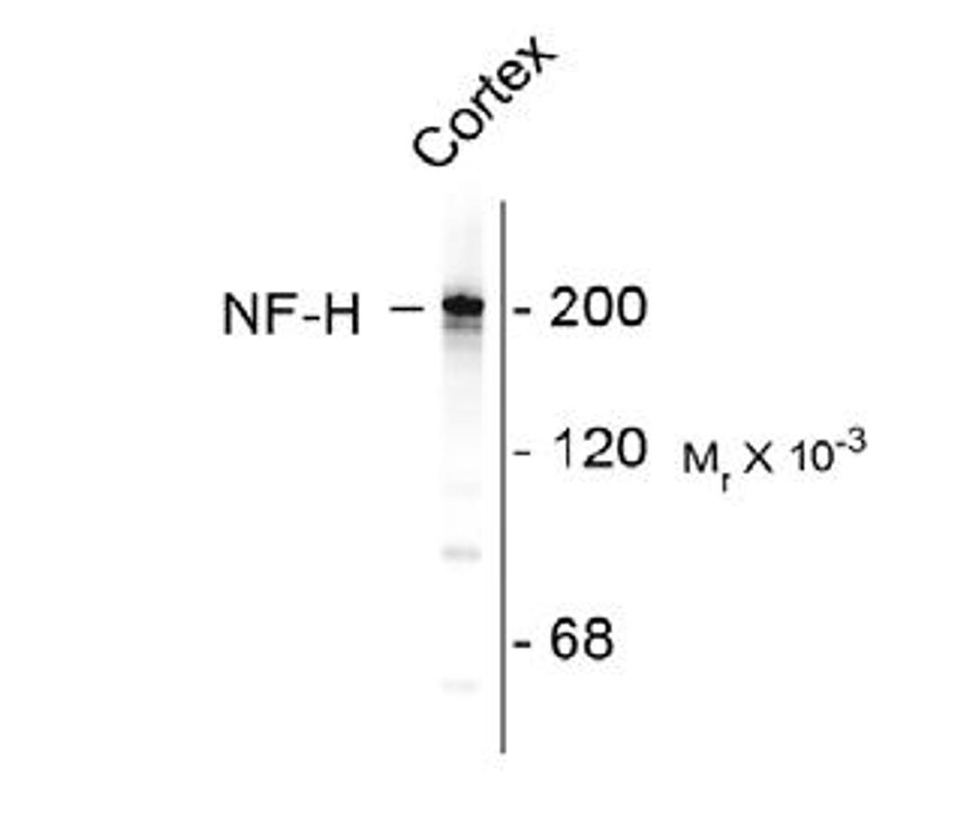 Western blot of rat cortex lysate showing specific immunolableing of the ~ 200k NF-H protein.