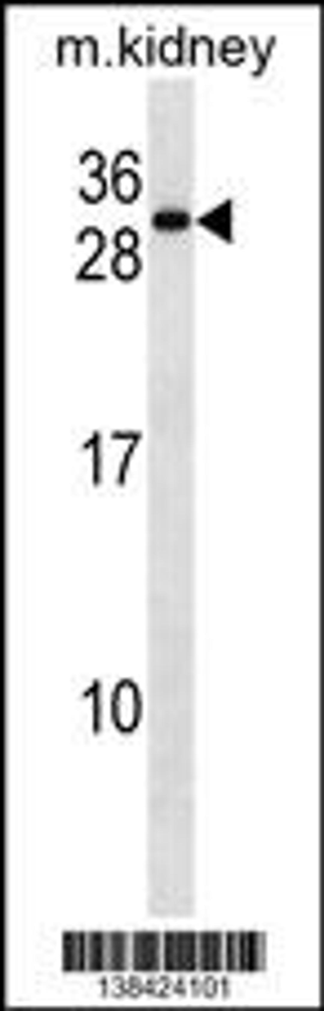 Western blot analysis in mouse kidney tissue lysates (35ug/lane).